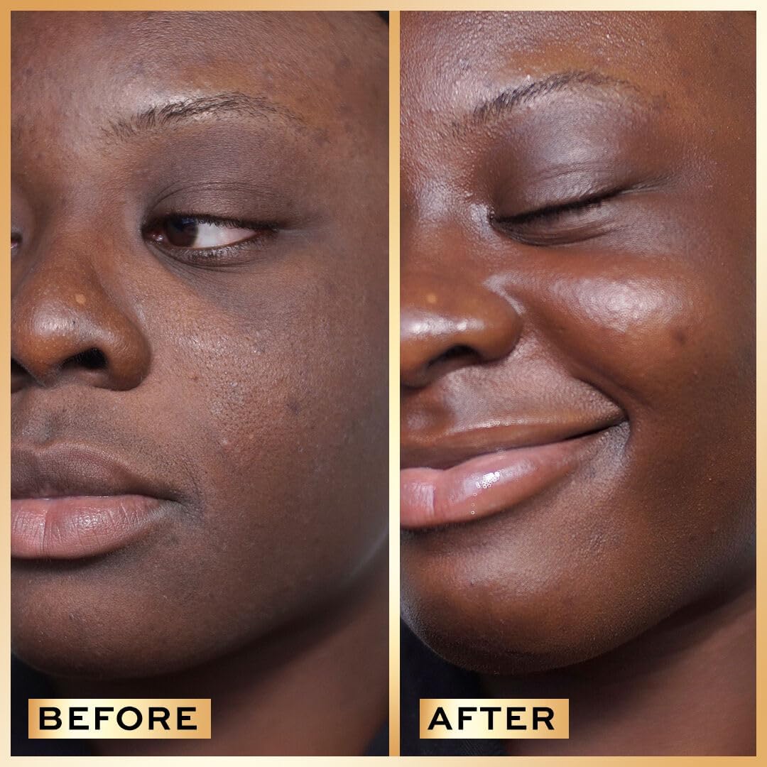 Revolution Pro, Miracle Serum, Hydrating Face Serum, Reduces Dullness, Improves Uneven Skin Tone, Contains Hyaluronic Acid & Niacinamide, 30ml