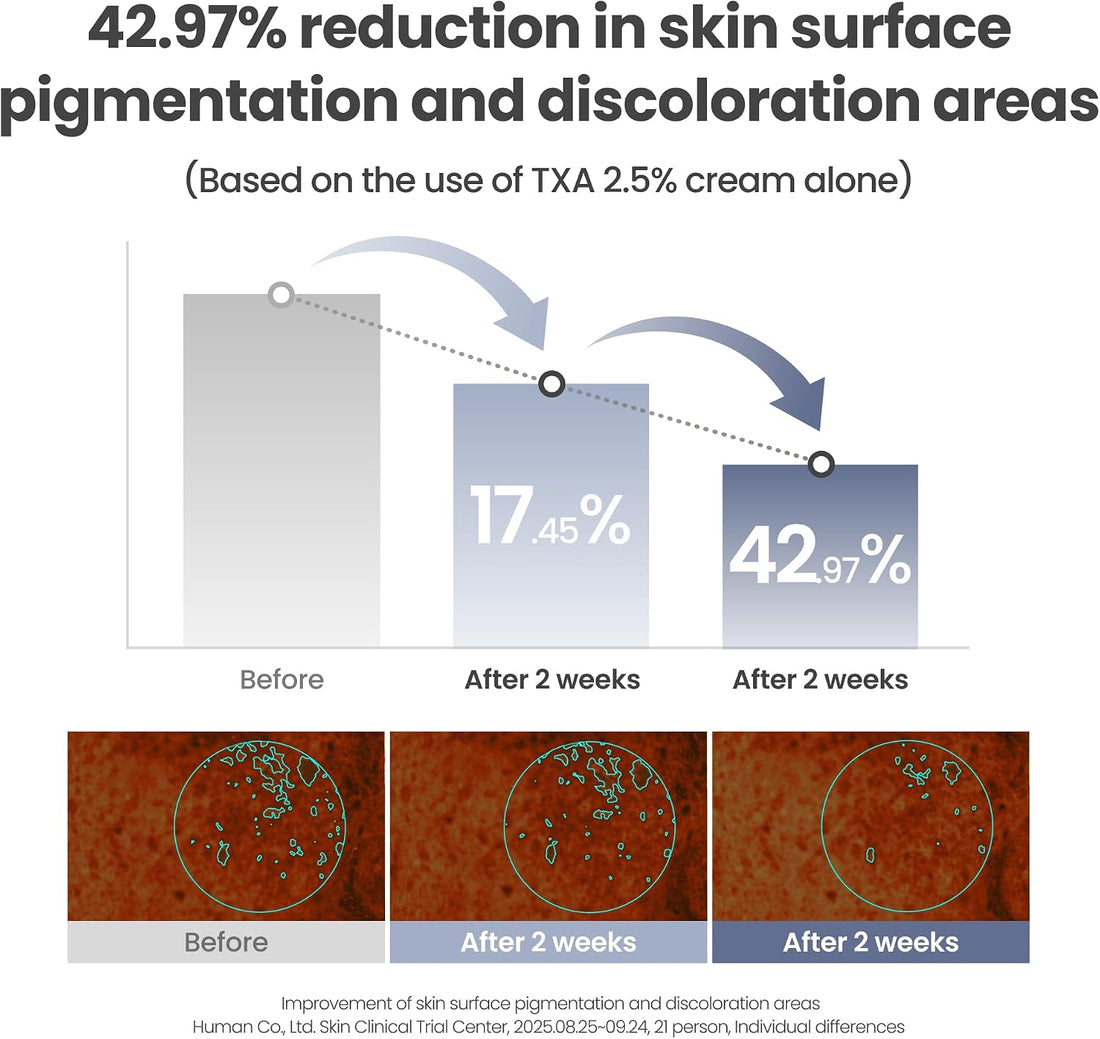 AXIS-Y TXA 2.5% Intensive Brightening Cream - Tranexamic Acid, Niacinamide & Glutathione for Hyperpigmentation & Dark Spot Corrector - Vegan Korean Skin Care Moisturizer Face Cream - 50ml/1.69 fl. oz.