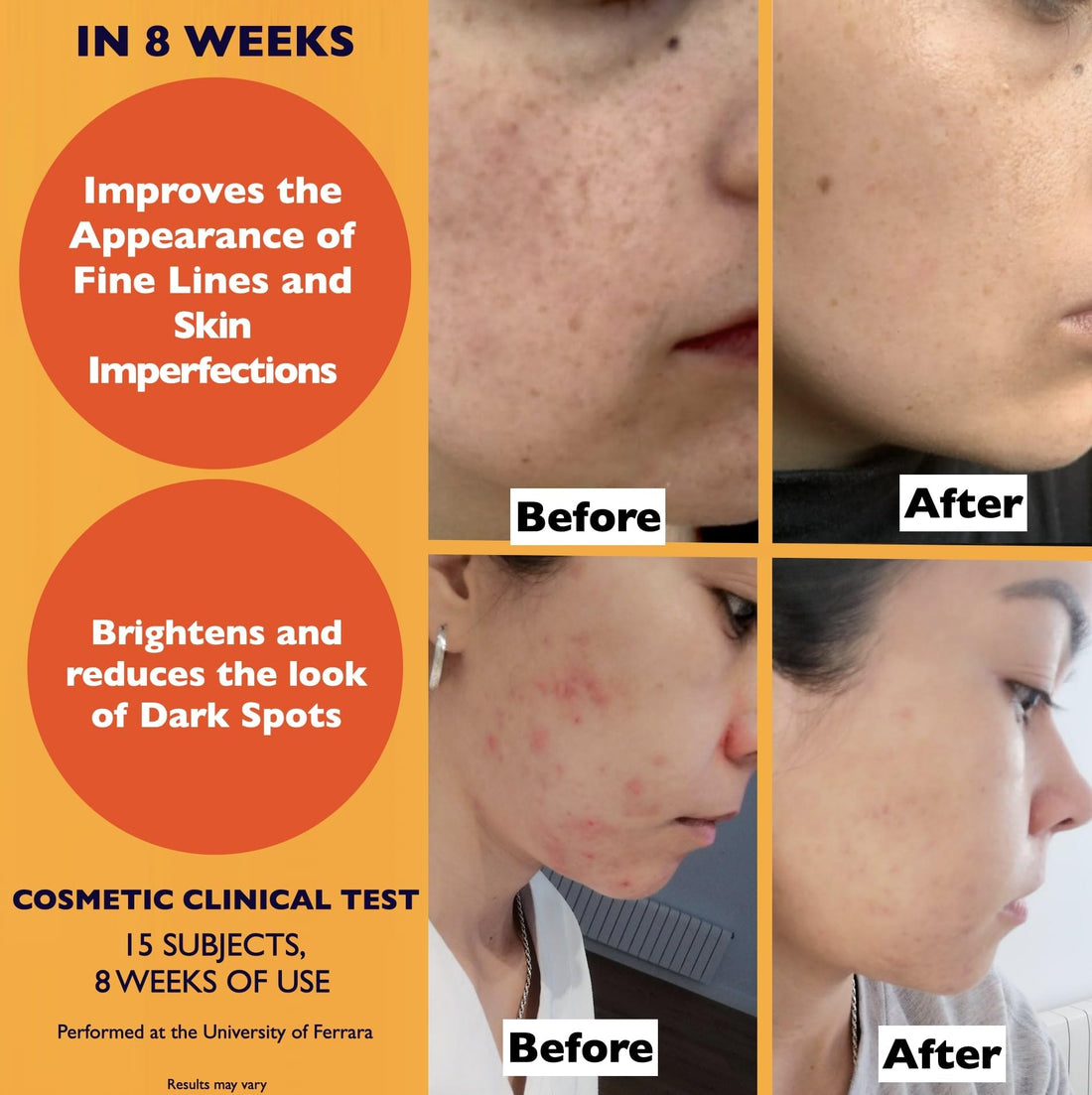 Big 2.11oz. Organic Vitamin C Serum for Face. Anti-Dark Spots, Wrinkles Skin Repair Serum with Hyaluronic Acid, Vitamin C & Niacinamide. All-in-One Brightening, Anti Aging Facial & Eye Area Skincare Halalzen