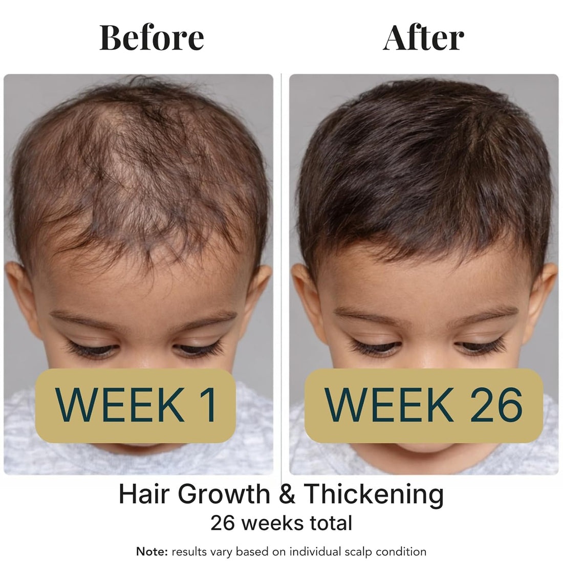 Revatology Kids & Baby Hair Growth Oil, Gentle Pre-Wash Dry/Itchy Scalp Treatment, Coconut, Rosemary, Castor, Amla +25 Botanicals Hair Oil for Toddlers, Curly & All Hair Types, Ayurvedic (Made in USA) Halalzen