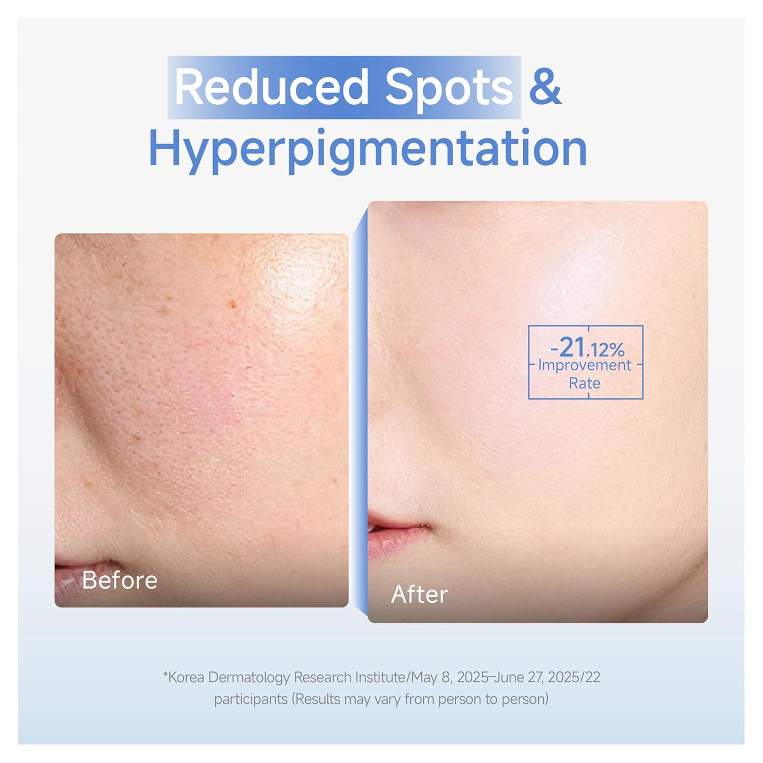 DAERA Synergy Boost Ampoule – Korean Brightening & Hydrating Face Serum, Dark Spot Correcting & Anti-Aging Ampoule with Calcium Up+ Complex, Firming Serum for Glowing Skin, 30ml Halalzen