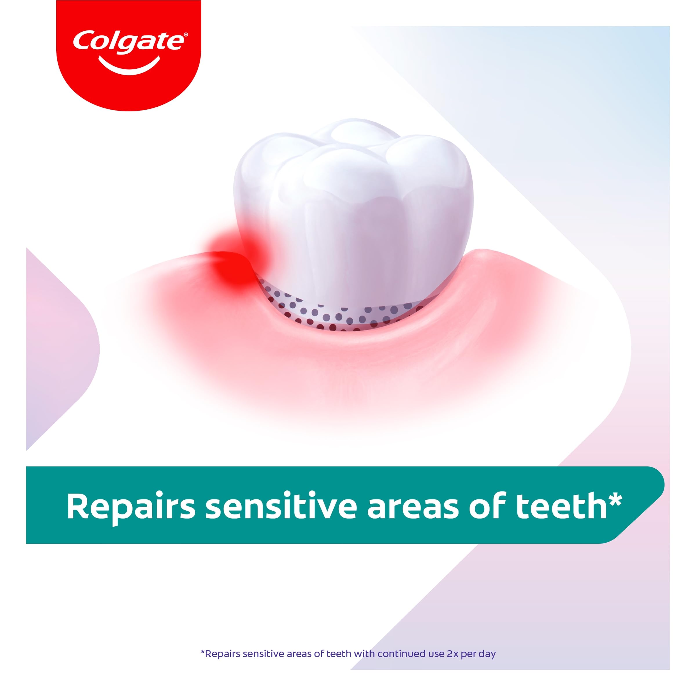 Colgate Sensitive Repair & Prevent + Gentle Whitening Toothpaste 75ml, Toothpaste for Sensitive Teeth, Acts in 1 Minute, Seals and Repairs Sensitive Areas of Teeth, Prevents Pain Coming Back