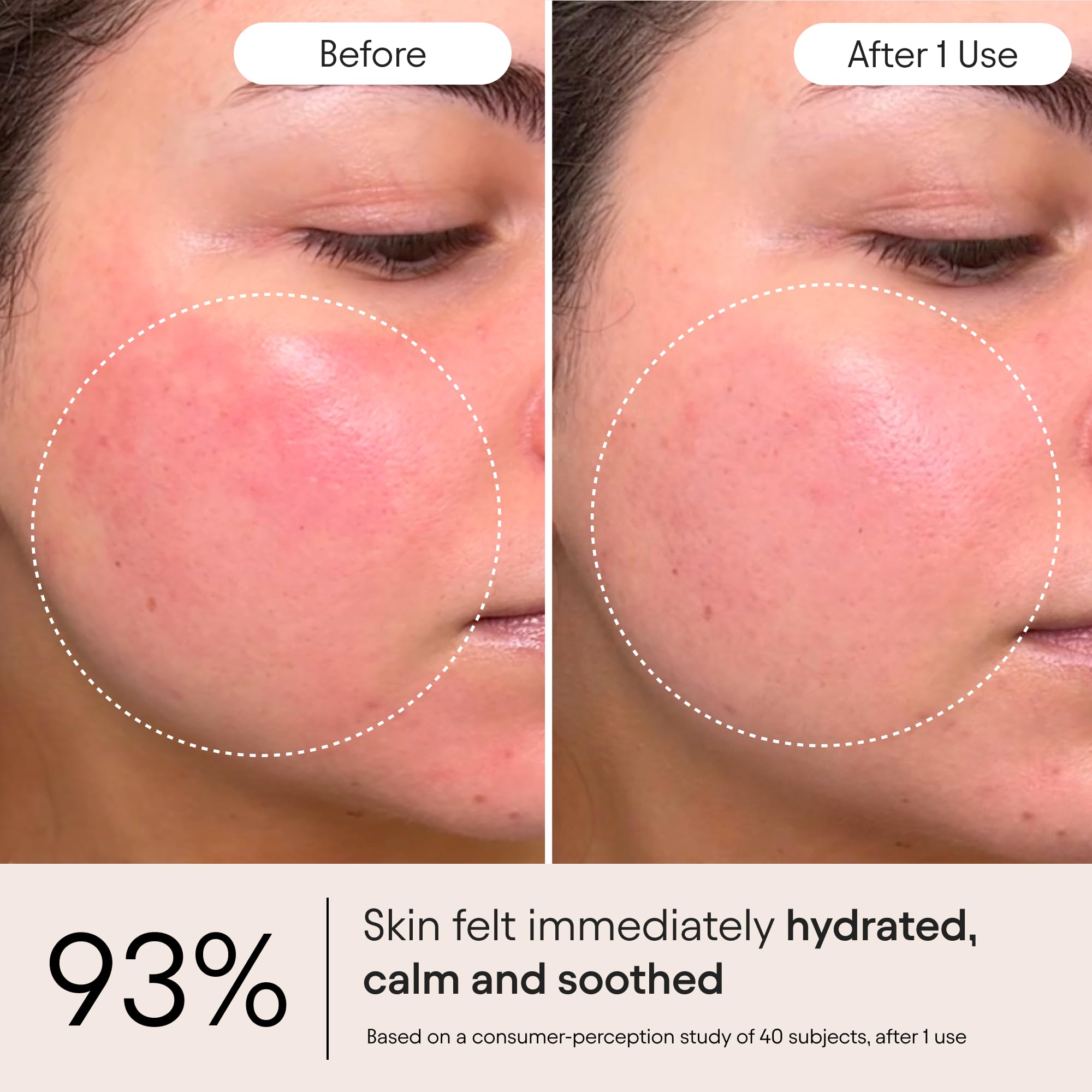 Alpyn Super Peptide & Ghostberry Moisturizer for Eczema, Barrier & Wrinkle Repair | Calm & Soothe Against Redness & Irritation | 1.7 oz / 50 ml Halalzen