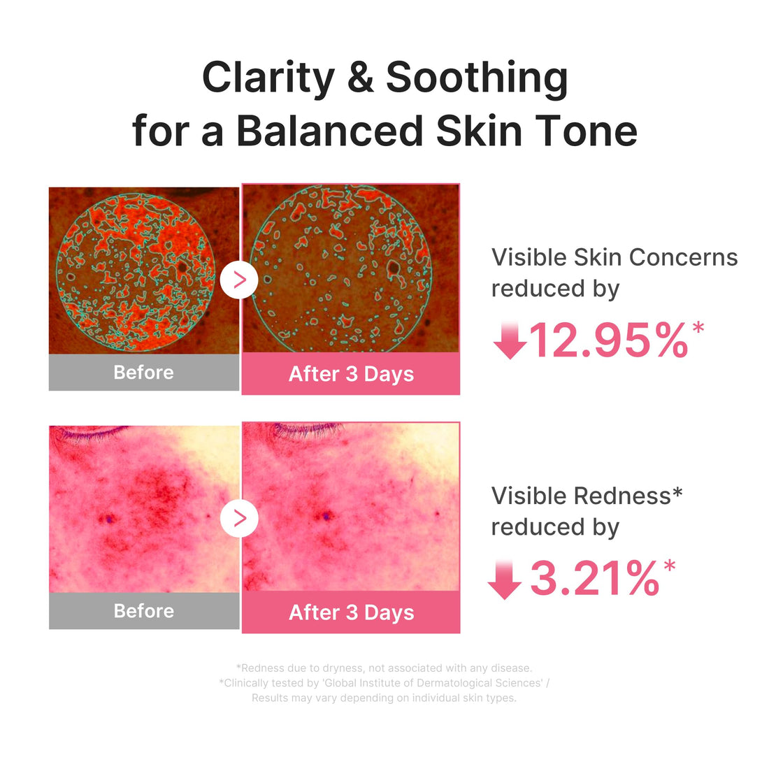 medicube PDRN Pink Peptide Serum with Salmon DNA | Pink Glow Serum with Peptides & Niacinamide for Hydration & Firm-Looking Skin | Uneven Tone Care | Korean Skincare, 1.01 fl. Oz Halalzen