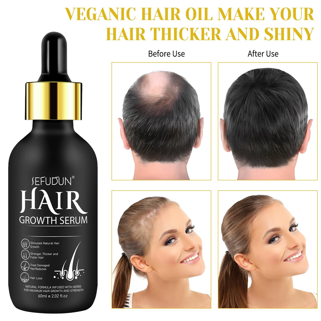 Veganic Hair Oil,100% Natural Growth With Caffeine,Biotin,Coconut,Macadamia,Rosemary and Castor for Growth,Thickening Hair Mask & Loss Treatment,60ml