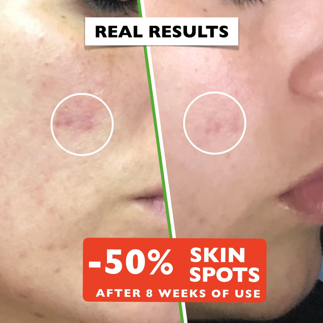 Big 2.11oz. Organic Vitamin C Serum for Face. Anti-Dark Spots, Wrinkles Skin Repair Serum with Hyaluronic Acid, Vitamin C & Niacinamide. All-in-One Brightening, Anti Aging Facial & Eye Area Skincare Halalzen