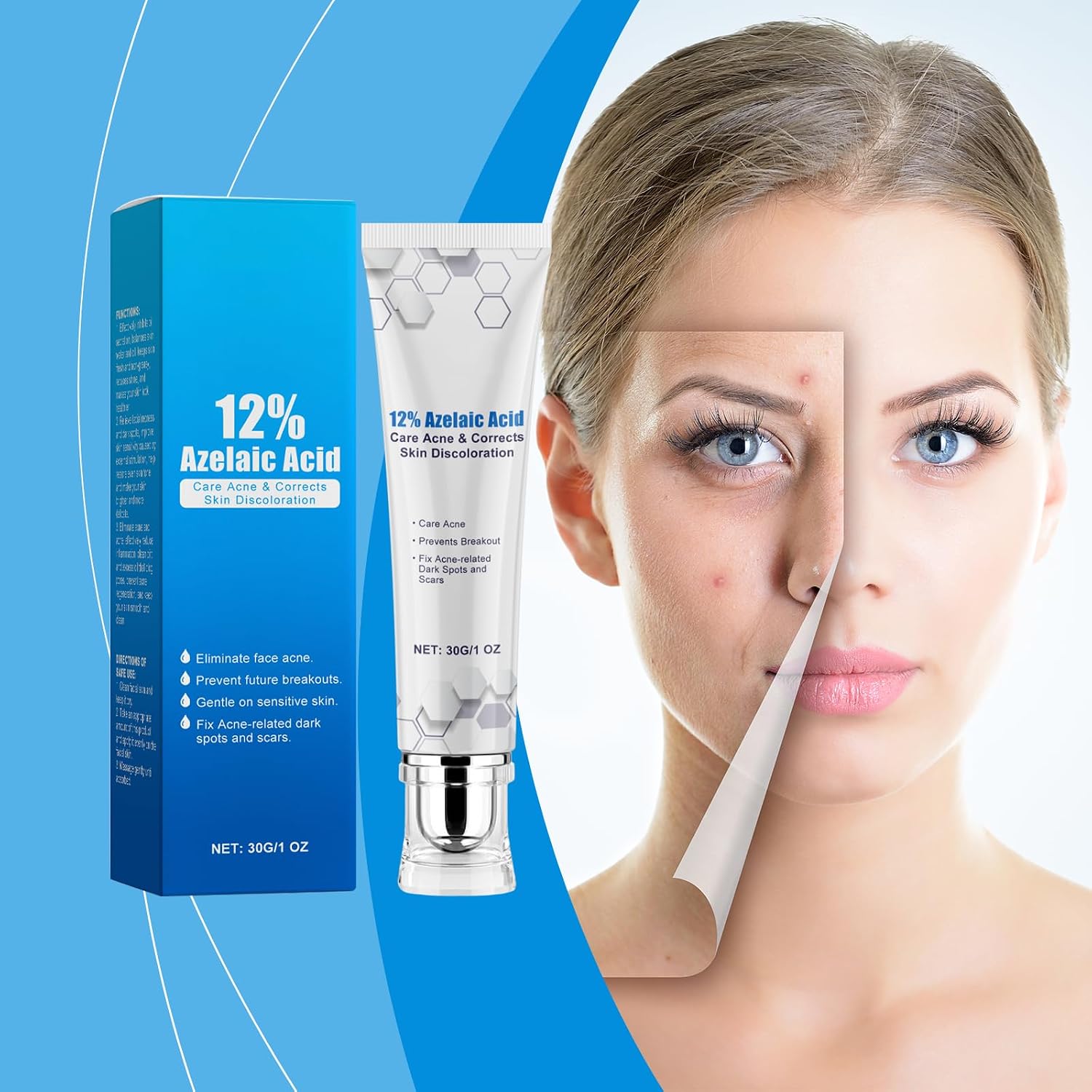 12% Acid Spot Cream, Dark Spot Remover for Face, Types Alleviate Face Skin Care Pigmentation Suitable for All Skin Halalzen