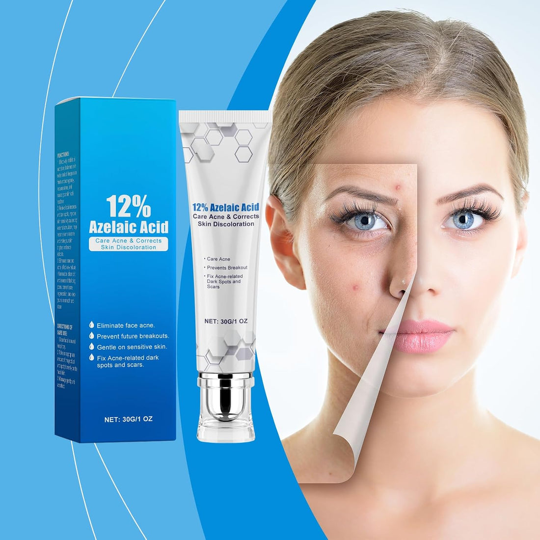 12% Acid Spot Cream, Dark Spot Remover for Face, Types Alleviate Face Skin Care Pigmentation Suitable for All Skin Halalzen