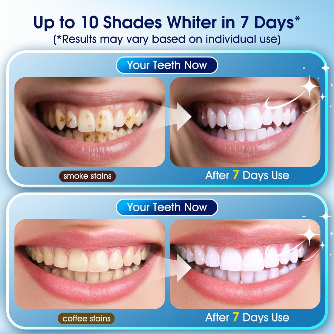 Teeth Whitening Kit with LED Light – 3 Teeth Whitening Gel Pens + 2 Remineralizing Desensitizing Gel Pens –35% Pap Whitening Formula – Whiten Teeth in 7 Days – Safe for Sensitive Teeth (Mint)