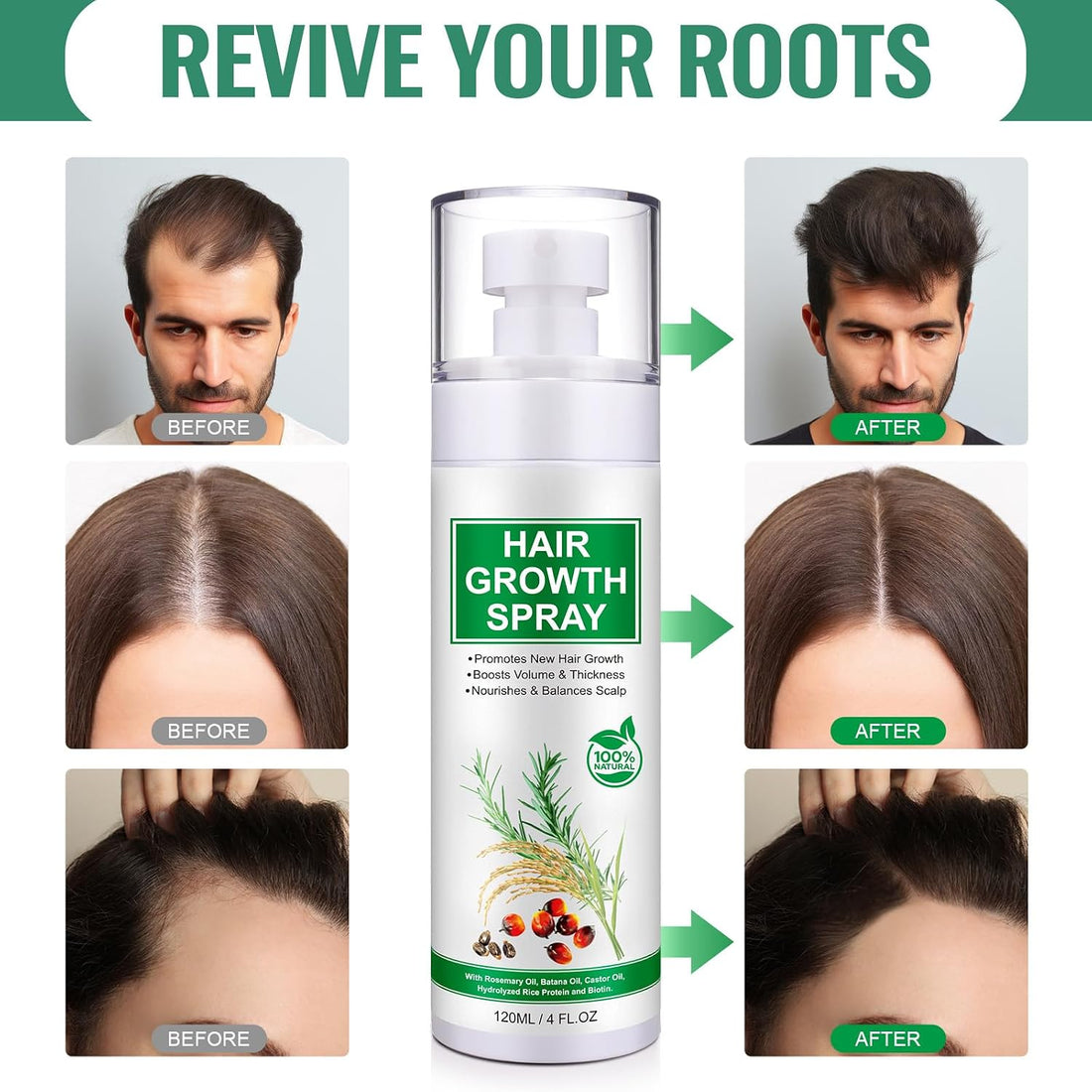 Hair Growth Serum Spray 120ml with Biotin, Rosemary & Castor Oil - Natural Hair Loss Treatment & Thickening Scalp Care with Batana Oil, Caffeine & Ginseng - For Women & Men, All Hair Types