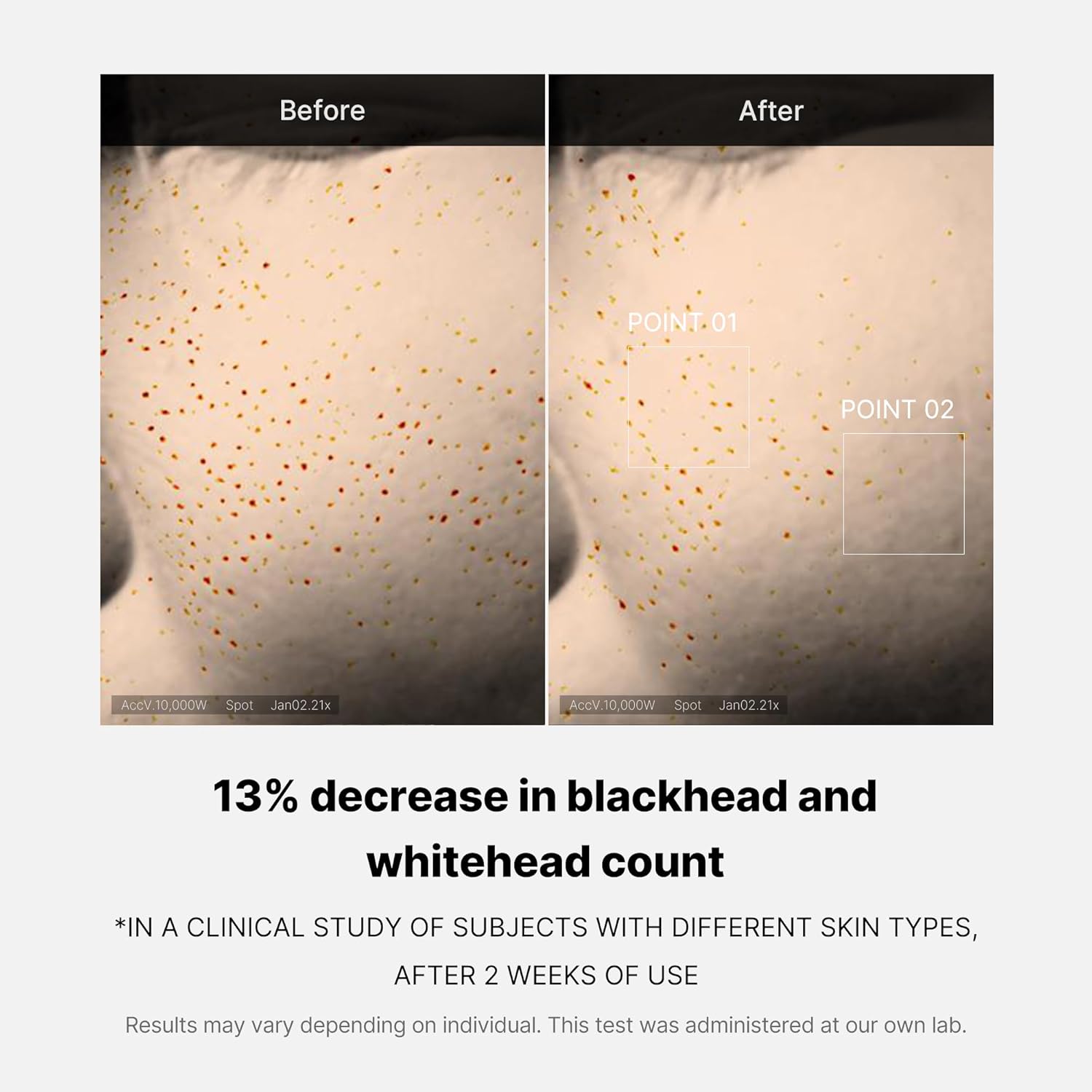 medicube Medicube Zero Pore One-day Serum 1.01 fl.oz - Overnight Resurfacing Serum with Pore Tightening Complex - 15.2% AHA+BHA+PHA & 2% Niacinamide - 10.8% reduction in pore appearance after one Halalzen