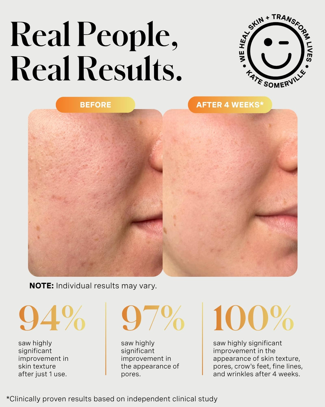 Kate Somerville ExfoliKate Intensive Exfoliating Treatment – Salicylic Acid and Lactic Acid Super Facial Scrub and Mask, Improves Texture and Pores