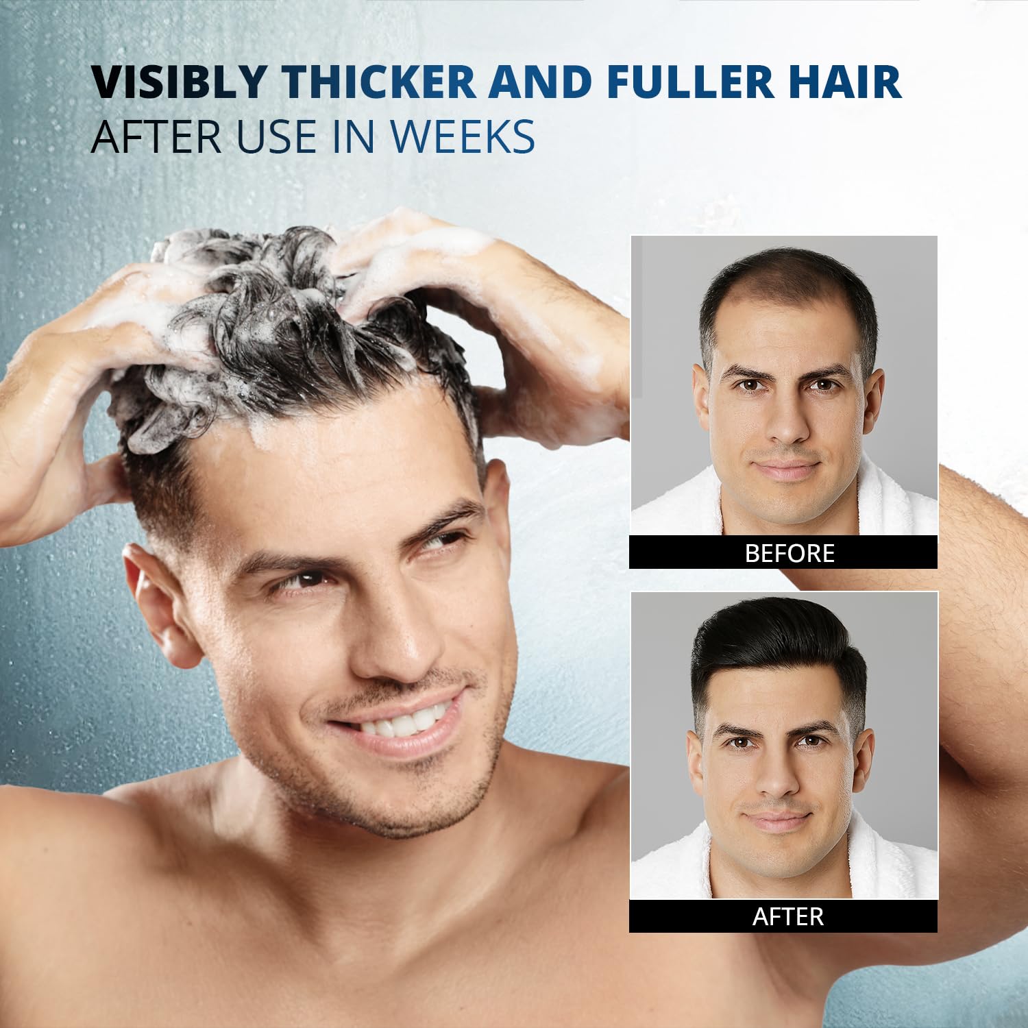 Hair Growth Shampoo with Rosemary Oil & Ginger – Thickening Formula for Thinning Hair, Hair Loss Treatment for Men & Women, Sulfate Free Natural Shampoo (300ml (Pack of 1))