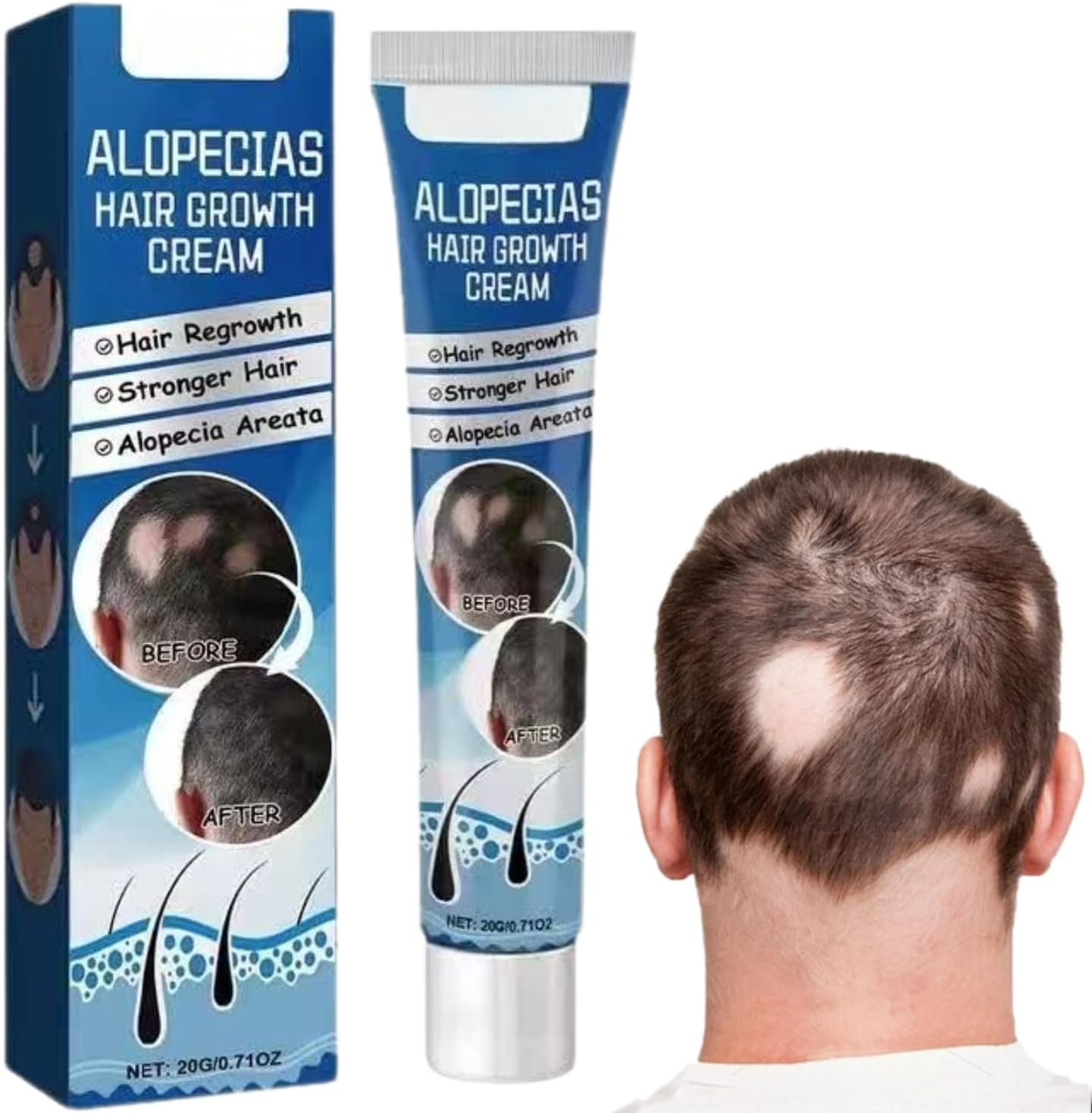 Alopecia Ha-ir Growth Cream,H-air Los/s Treatment for Women,H-air Loss Treatment for Men,Rogaine H-air Regrowth Men，Scalp Nourishing Anti Hair Loss Serum,Hair Thinning,Scalp Moisturizer，20g