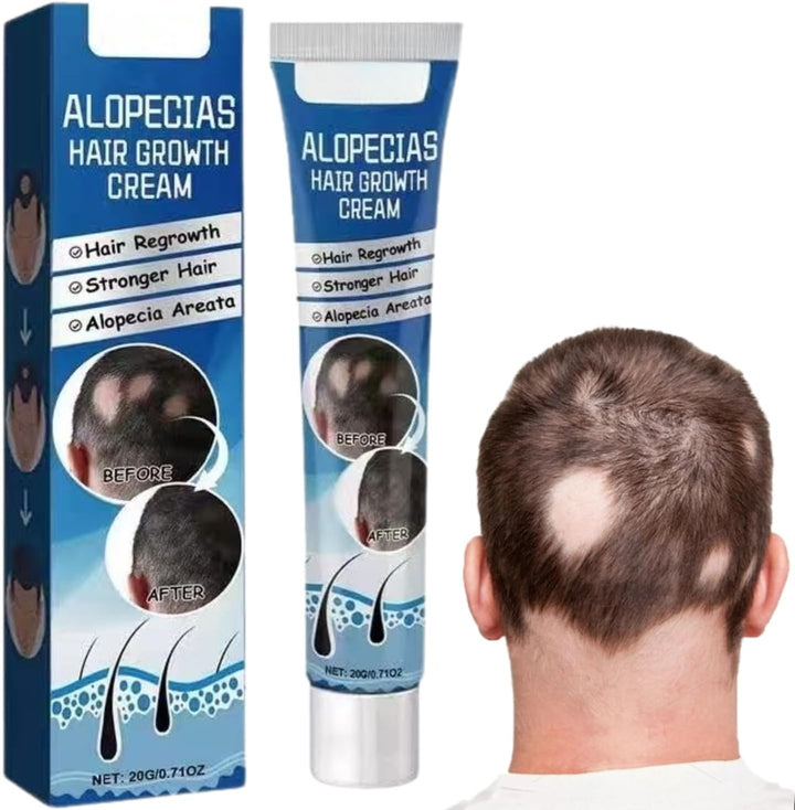 Alopecia Ha-ir Growth Cream,H-air Los/s Treatment for Women,H-air Loss Treatment for Men,Rogaine H-air Regrowth Men，Scalp Nourishing Anti Hair Loss Serum,Hair Thinning,Scalp Moisturizer，20g Halalzen