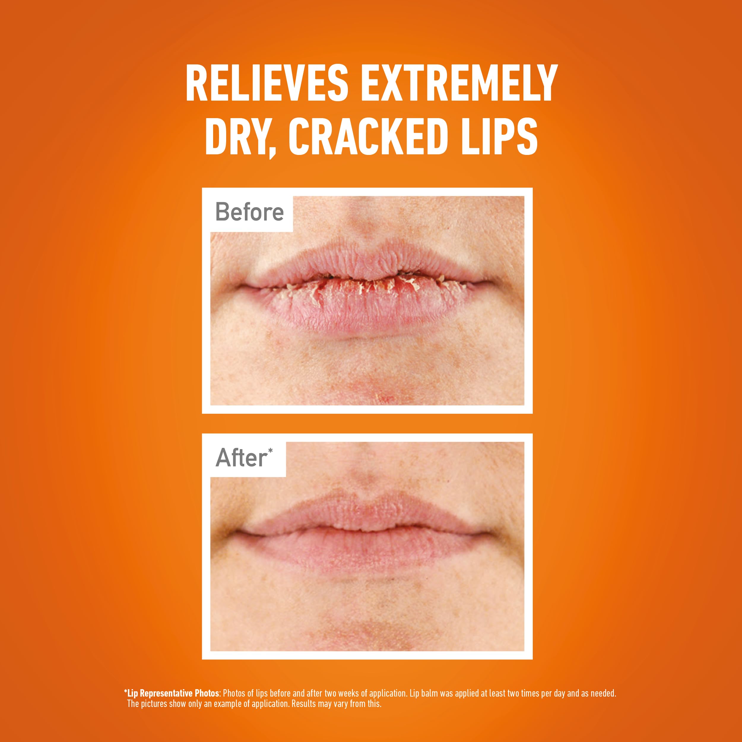 O'Keeffe's Lip Repair Unscented Lip Balm, 4.2g – For Extremely Dry, Cracked Lips | All-Day Moisture with 7 Moisturising Ingredients Halalzen
