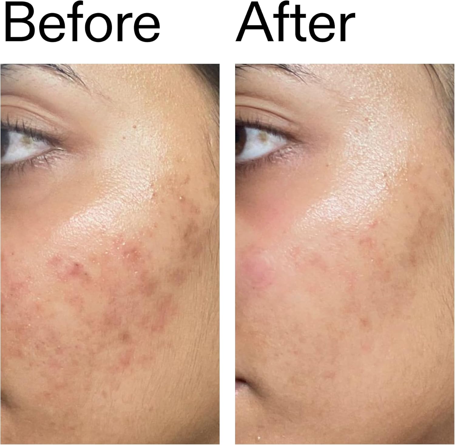 The INKEY List Ectoin Hydro-Barrier Serum 30ml, Advanced Dual-Action Serum, Boosts Hydration, Builds Stronger Skin Barrier, Lightweight Texture