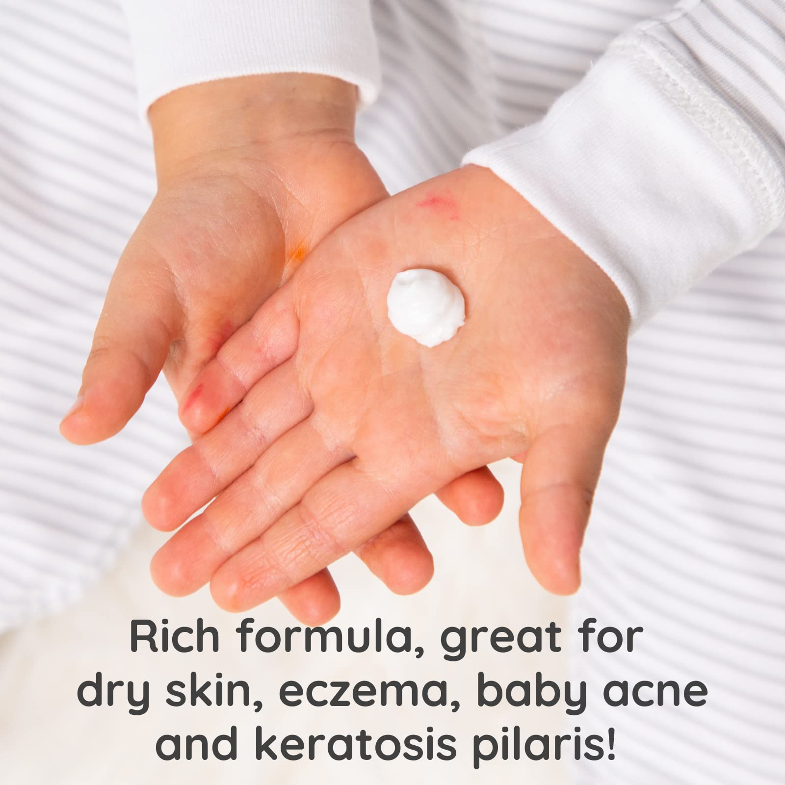 Bubbsi Whipped Coconut Oil Baby Lotion for Eczema, Dry Skin, Baby Acne, KP | Organic Coconut Oil, Shea Butter, Vitamin E | Light, Natural Scent | EU Compliant, Vegan (Refillable, 8oz) Halalzen