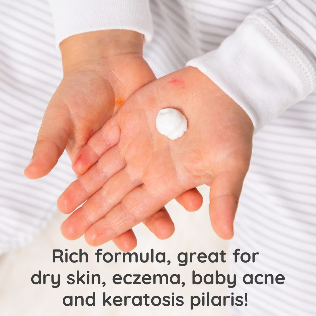 Bubbsi Whipped Coconut Oil Baby Lotion for Eczema, Dry Skin, Baby Acne, KP | Organic Coconut Oil, Shea Butter, Vitamin E | Light, Natural Scent | EU Compliant, Vegan (Refillable, 8oz) Halalzen