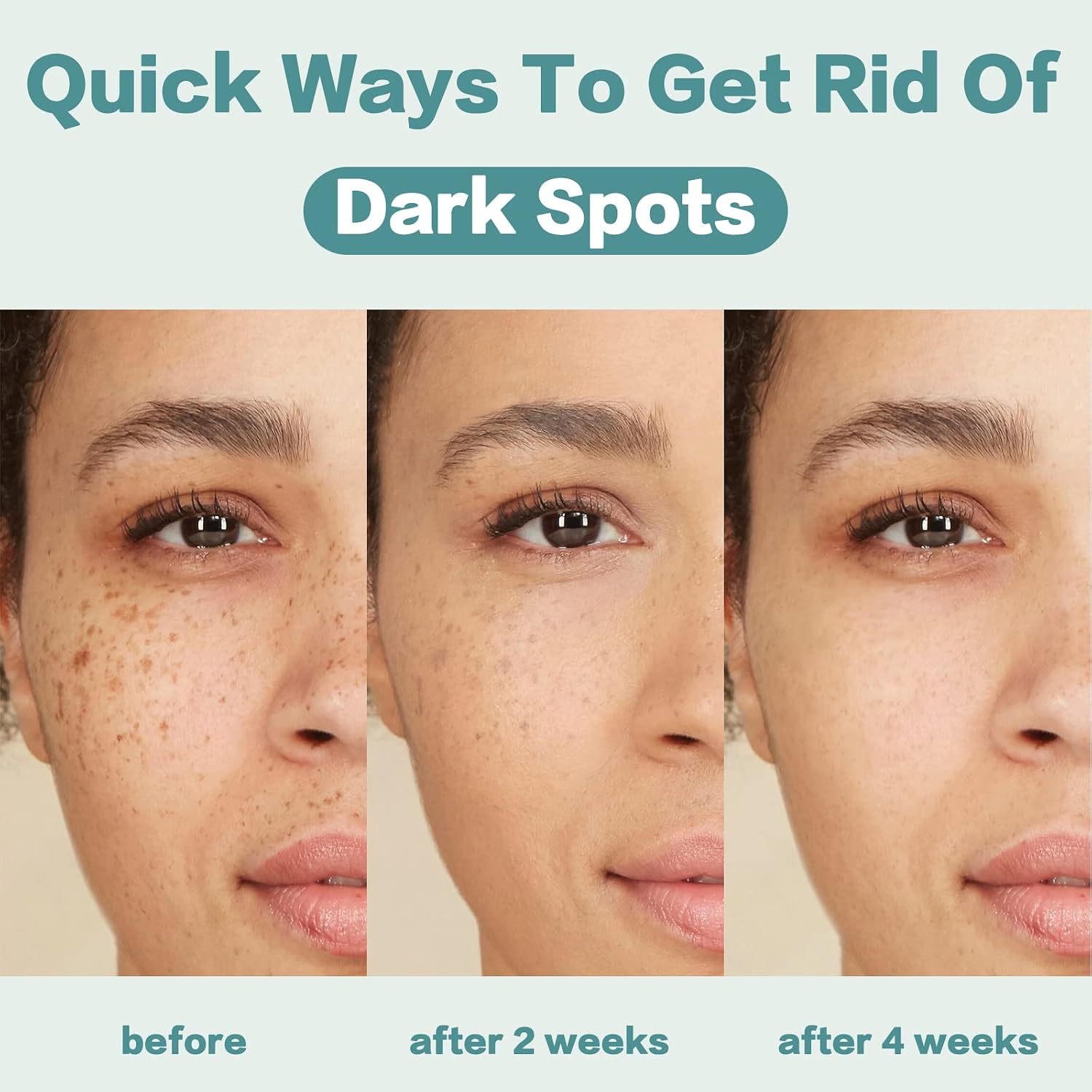 Dark Spot Remover for Face and Body: Dark Spot Corrector Cream - Enriching Skin Care for All Skin Tones - Ideal for Sun Spots, Melasma, Freckles, and Blemish Reduction 1 fl oz Halalzen