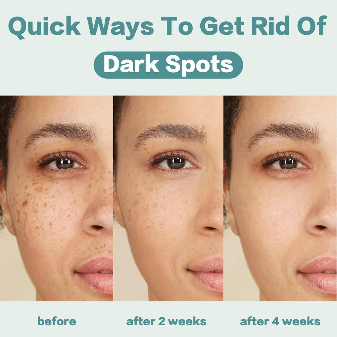 Dark Spot Remover for Face and Body: Dark Spot Corrector Cream - Enriching Skin Care for All Skin Tones - Ideal for Sun Spots, Melasma, Freckles, and Blemish Reduction 1 fl oz Halalzen