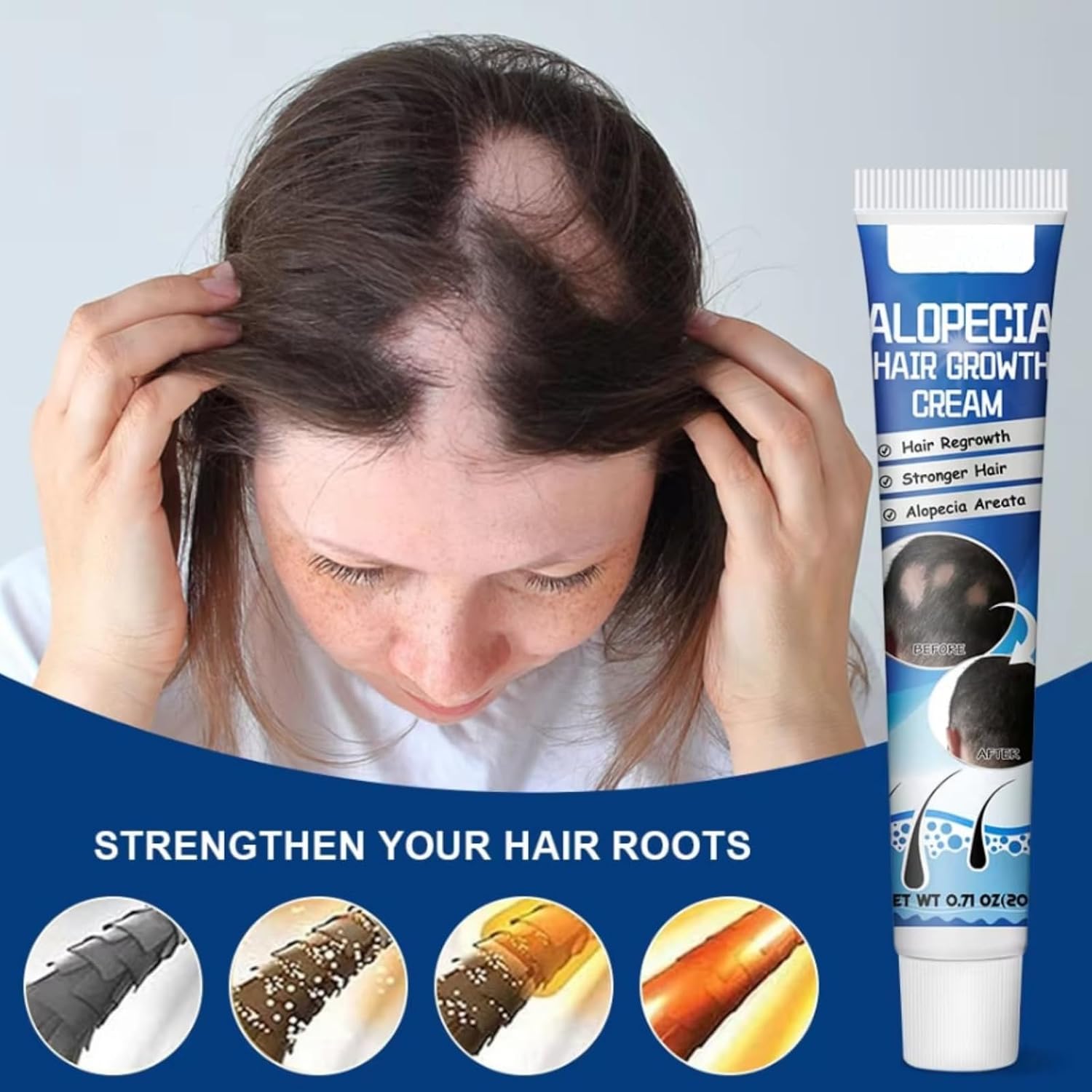 Alopecia Ha-ir Growth Cream,H-air Los/s Treatment for Women,H-air Loss Treatment for Men,Rogaine H-air Regrowth Men，Scalp Nourishing Anti Hair Loss Serum,Hair Thinning,Scalp Moisturizer，20g