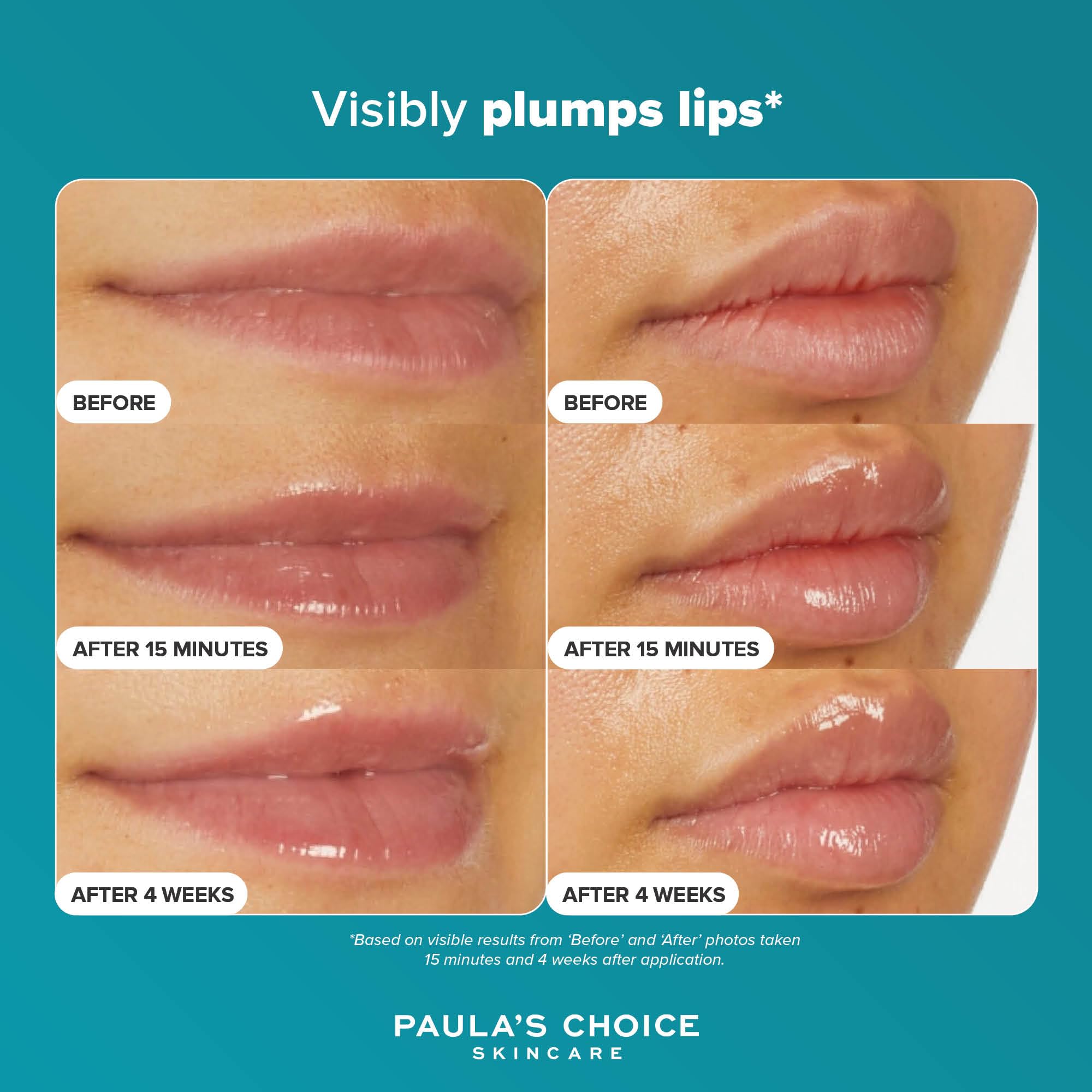 Paula's Choice Pro-Collagen Peptide Gloss Balm - Deeply Hydrates - Anti-Ageing - Plumps & Smooths Lips - Non-sticky with Glossy Finish - Lip Treatment with Shea Butter - All Skin Types - 15 ml Halalzen