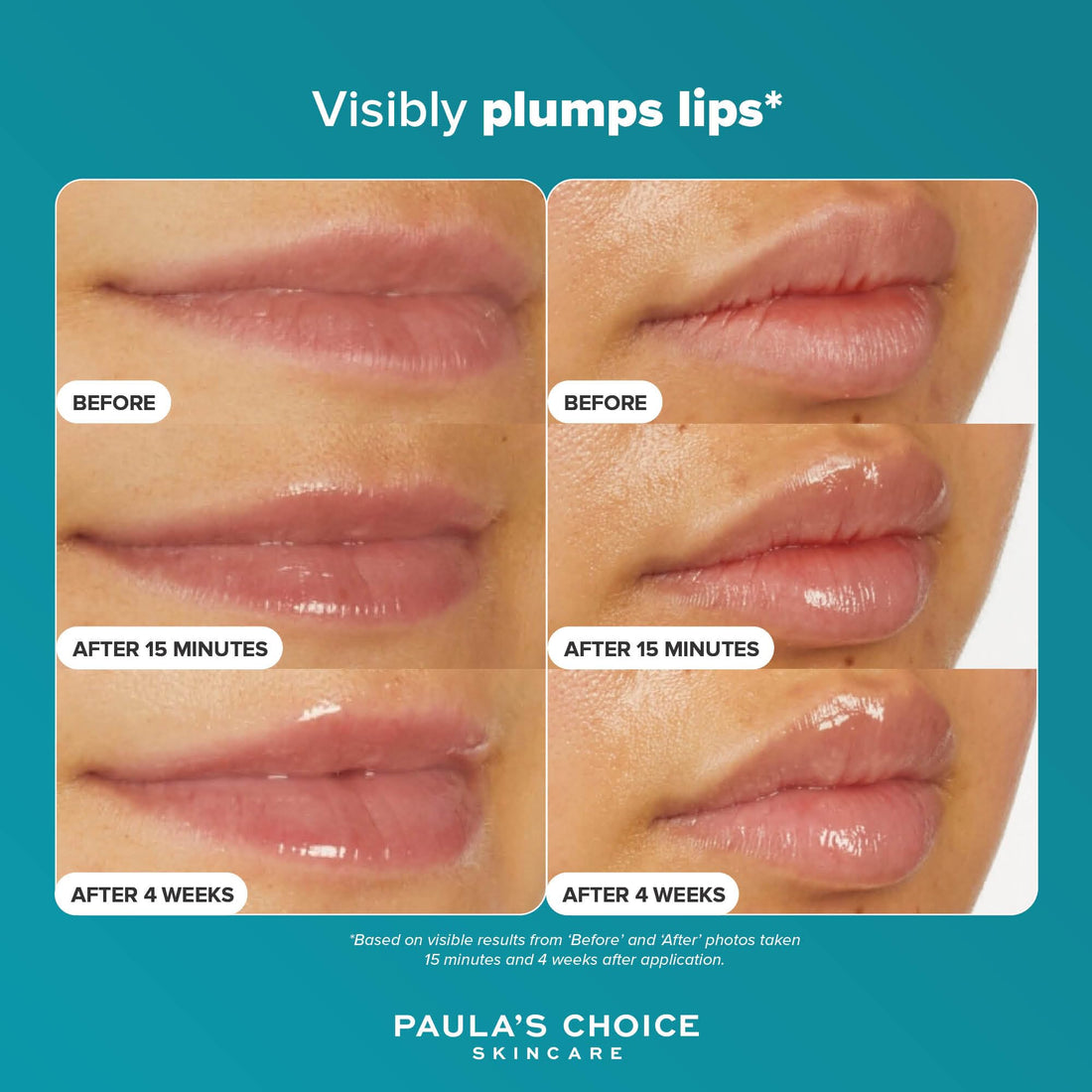 Paula's Choice Pro-Collagen Peptide Gloss Balm - Deeply Hydrates - Anti-Ageing - Plumps & Smooths Lips - Non-sticky with Glossy Finish - Lip Treatment with Shea Butter - All Skin Types - 15 ml Halalzen