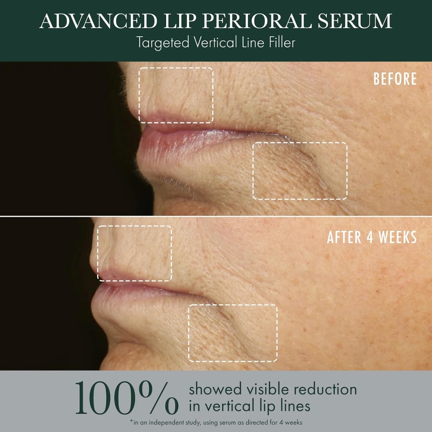 RéVive Advanced Perioral Lip Serum - Anti Aging Perioral Lip Treatment to Reduce Lip Area Lines & Wrinkles -Helps Restore Lip Contour & Visible Fullness(0.5 fl oz) Halalzen