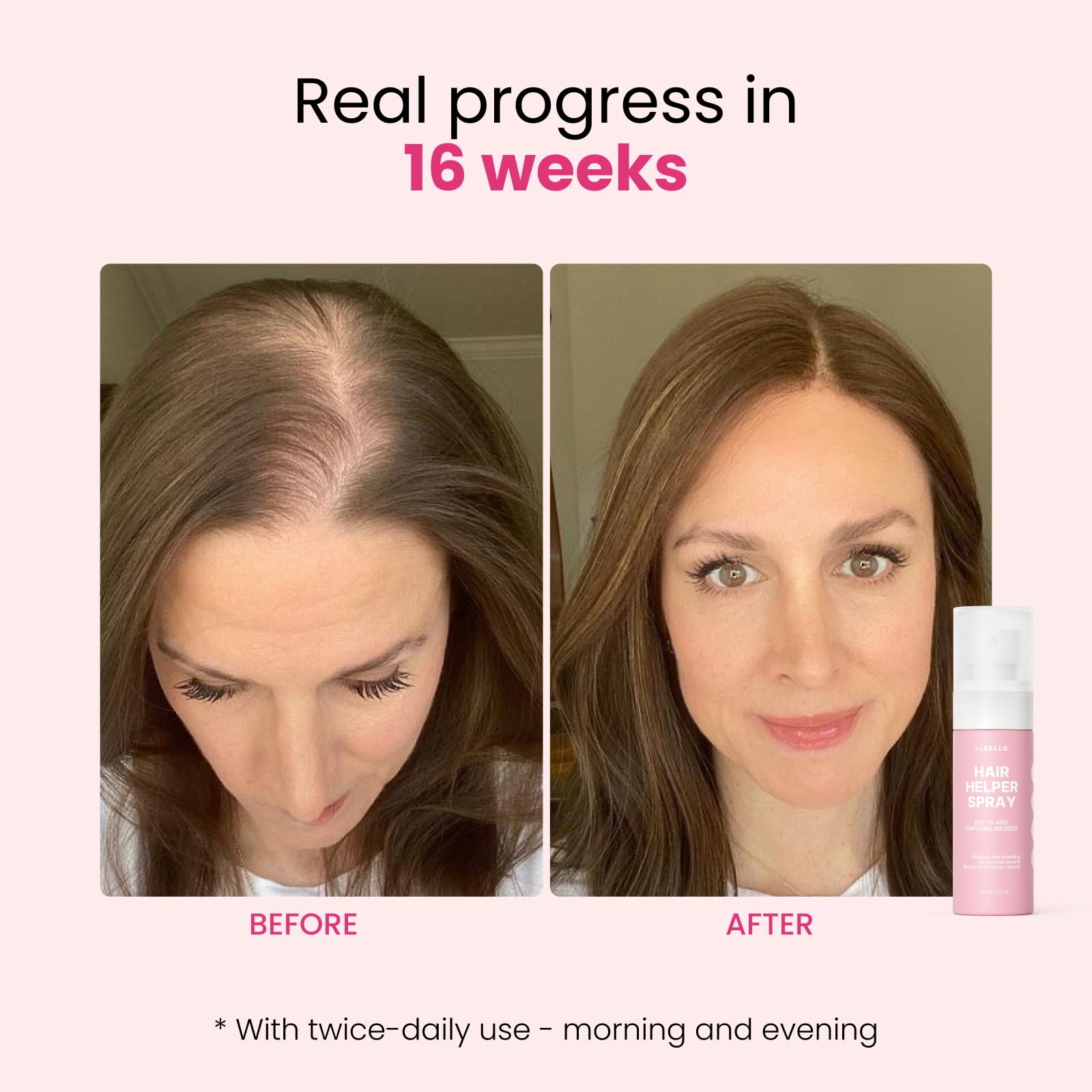 Spray Trybello Hair Helper | Sérum Bloqueur de DHT pour la Croissance des Cheveux avec Biotine, Huile de Ricin et Caféine | Usage Topique pour des Cheveux plus Épais et Volumineux | Anti-Chute, Formule Végétalienne et Sans Cruauté Animale