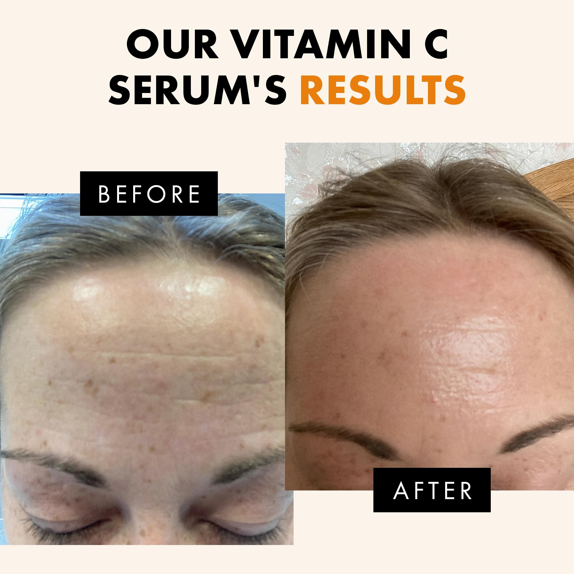 Eclat Skincare Glow Up Vitamin C Serum - Vitamin C Serum for Face with Hyaluronic Acid, Ferulic Acid & Vit E - Skin Brightening Face Care - Anti Aging, Hydrating & Dark Spot Lightening 30ml