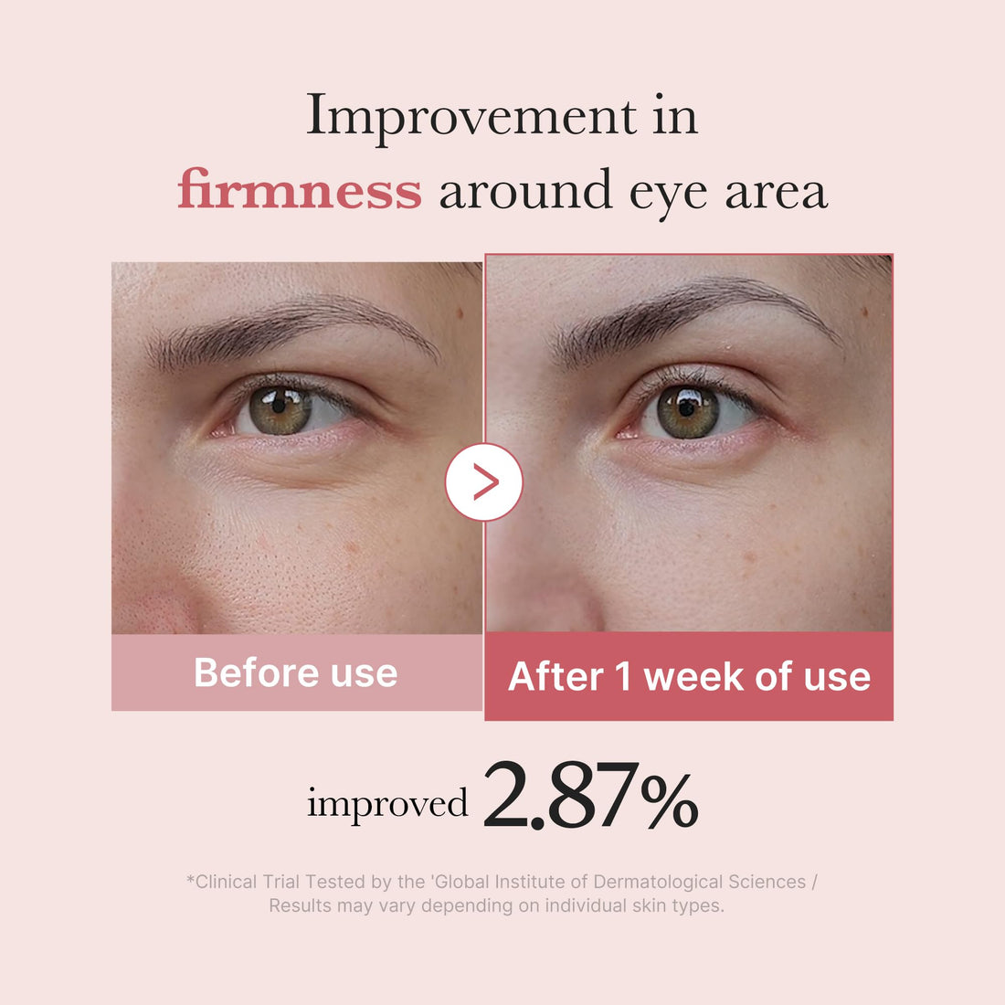 medicube Eye Serum with Salmon DNA PDRN & Pink Peptides | 99% Purity Retinol for Fine Lines | PDRN & Niacinamide for Uneven Skin Tone | Korean Skincare, 1.01 fl.oz Halalzen
