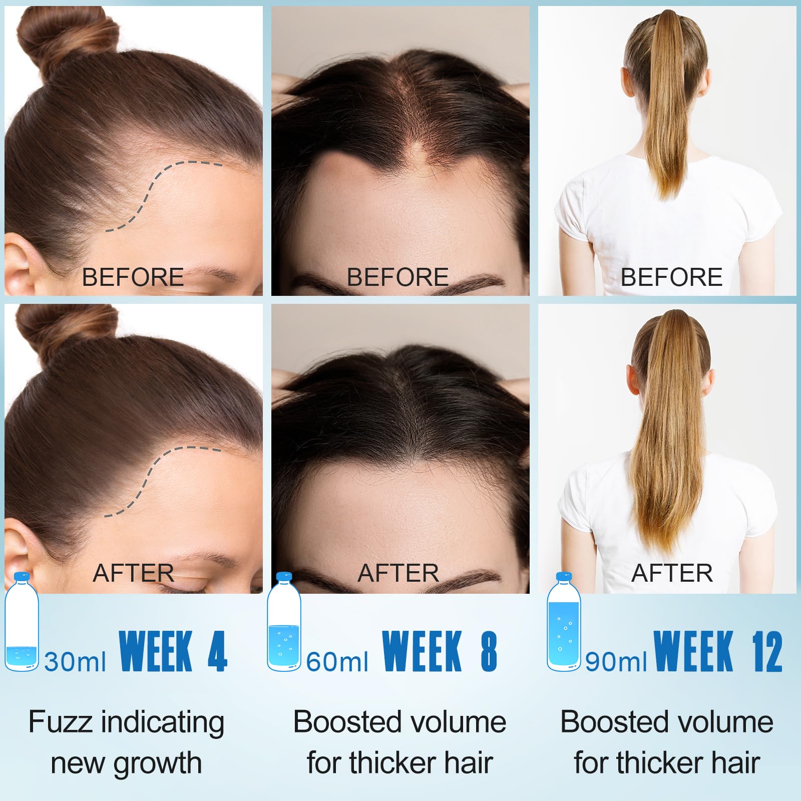 Rosemary Oil for Hair Growth,2x120ml Diluted Rosemary Oil and Hair Serum for Dry Damaged Hair,Proven Hair Loss Treatment & Hair Thickening Products