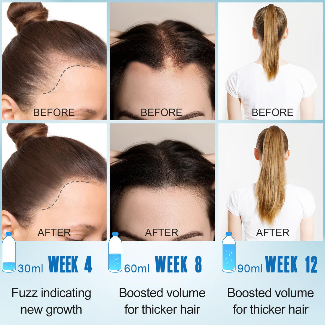 Rosemary Oil for Hair Growth,2x120ml Diluted Rosemary Oil and Hair Serum for Dry Damaged Hair,Proven Hair Loss Treatment & Hair Thickening Products