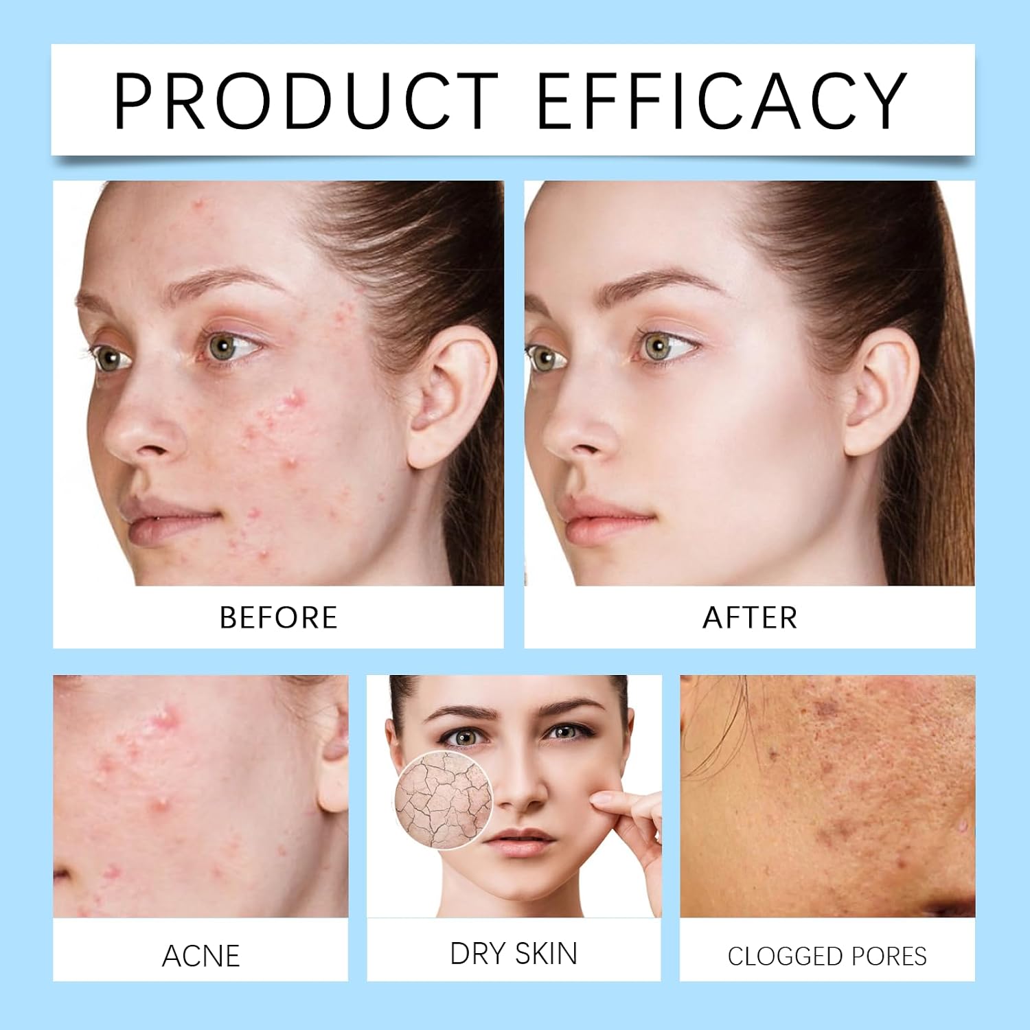 12% Acid Spot Cream, Dark Spot Remover for Face, Types Alleviate Face Skin Care Pigmentation Suitable for All Skin Halalzen