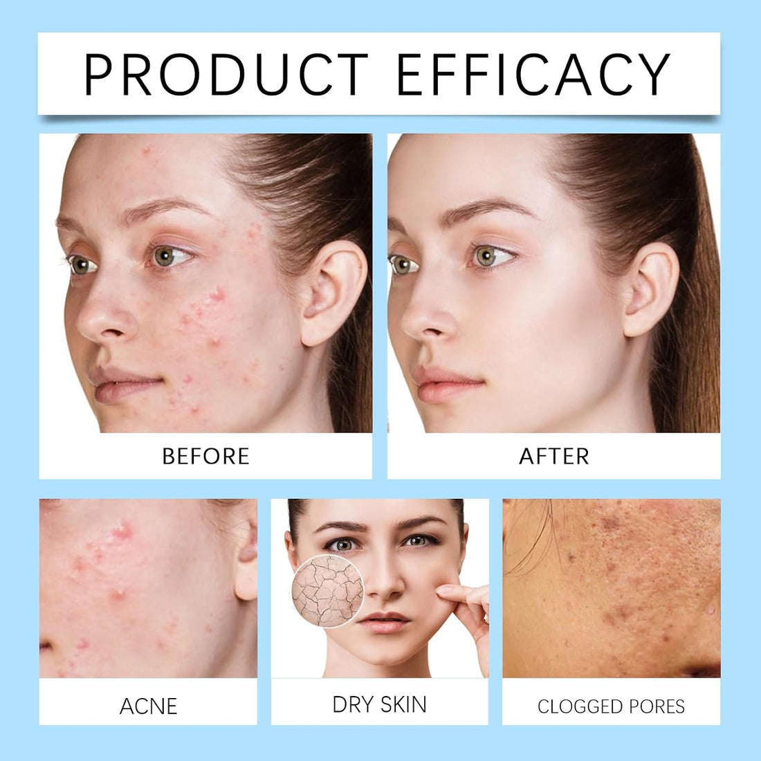 12% Acid Spot Cream, Dark Spot Remover for Face, Types Alleviate Face Skin Care Pigmentation Suitable for All Skin Halalzen
