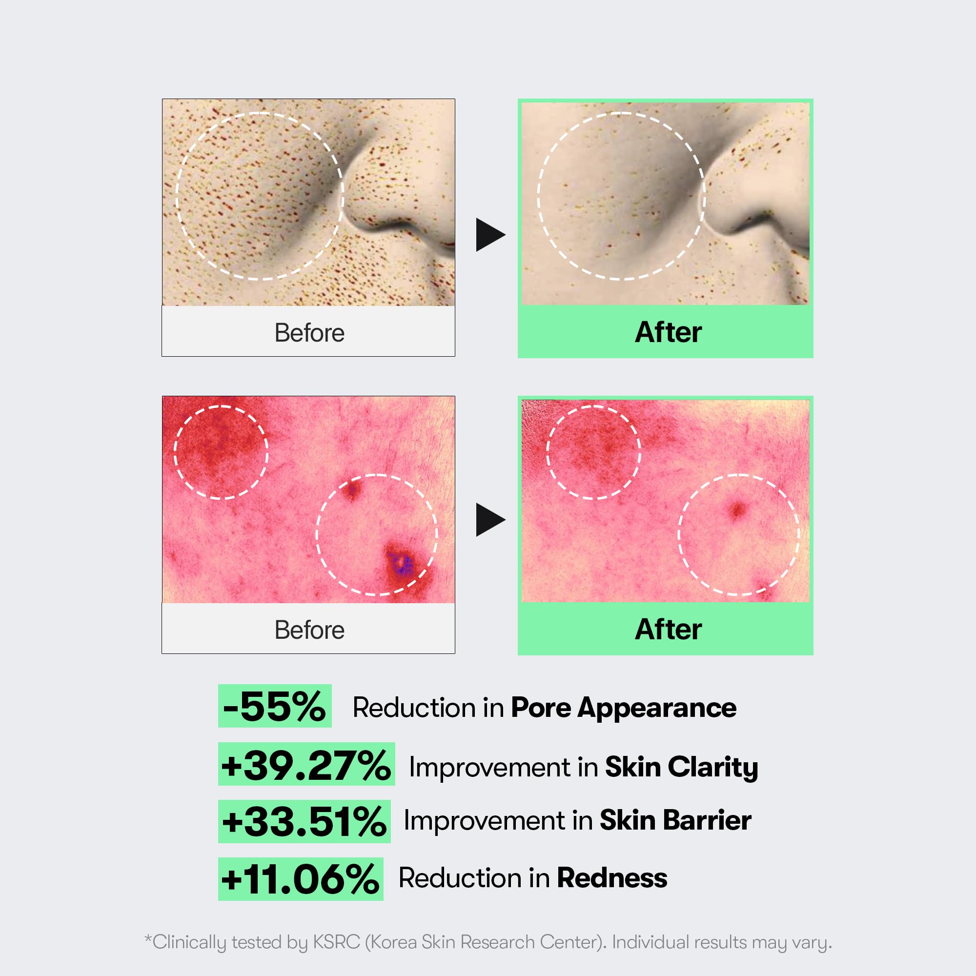 VT COSMETICS CICA Reedle Shot 300, Spicule Microneedling Serum for Pore Care & Exfoliation, Exosome & Centella Asiatica for Glass Skin, Smooth Skin Texture, Korean Skin Booster (1.69 Fl Oz / 50ml) Halalzen