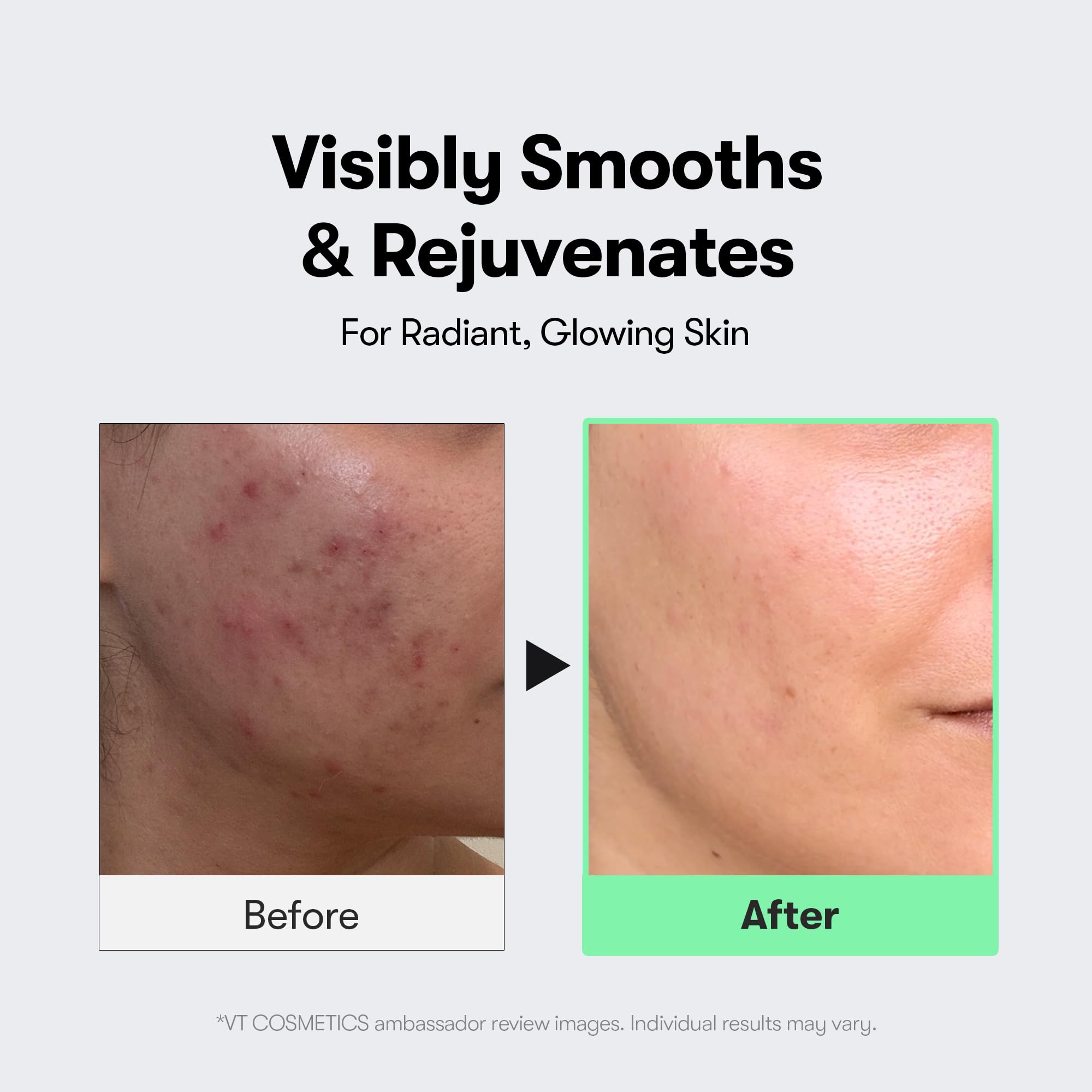 VT COSMETICS CICA Reedle Shot 300, Spicule Microneedling Serum for Pore Care & Exfoliation, Exosome & Centella Asiatica for Glass Skin, Smooth Skin Texture, Korean Skin Booster (1.69 Fl Oz / 50ml) Halalzen