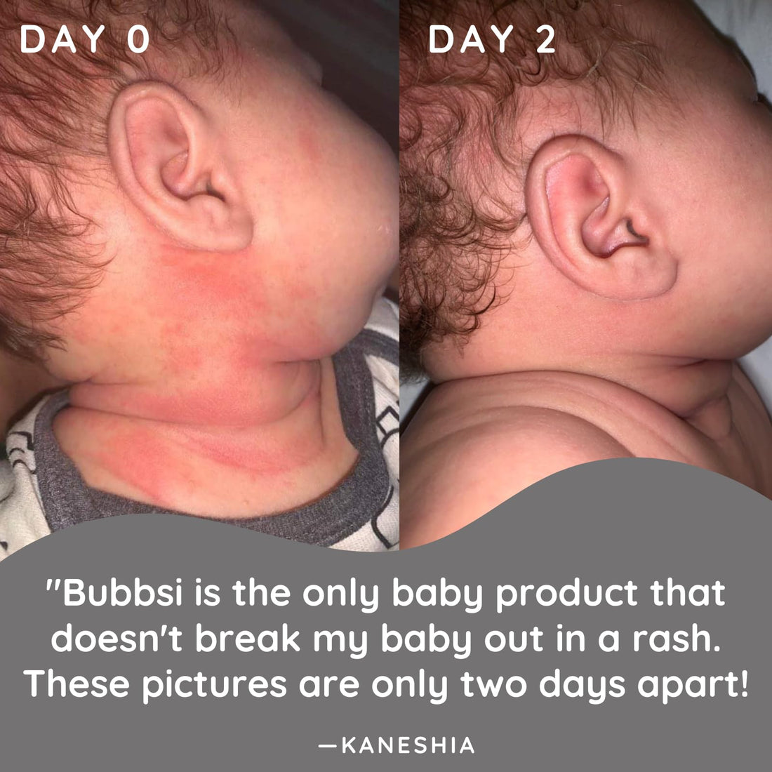 Bubbsi Whipped Coconut Oil Baby Lotion for Eczema, Dry Skin, Baby Acne, KP | Organic Coconut Oil, Shea Butter, Vitamin E | Light, Natural Scent | EU Compliant, Vegan (Refillable, 8oz) Halalzen