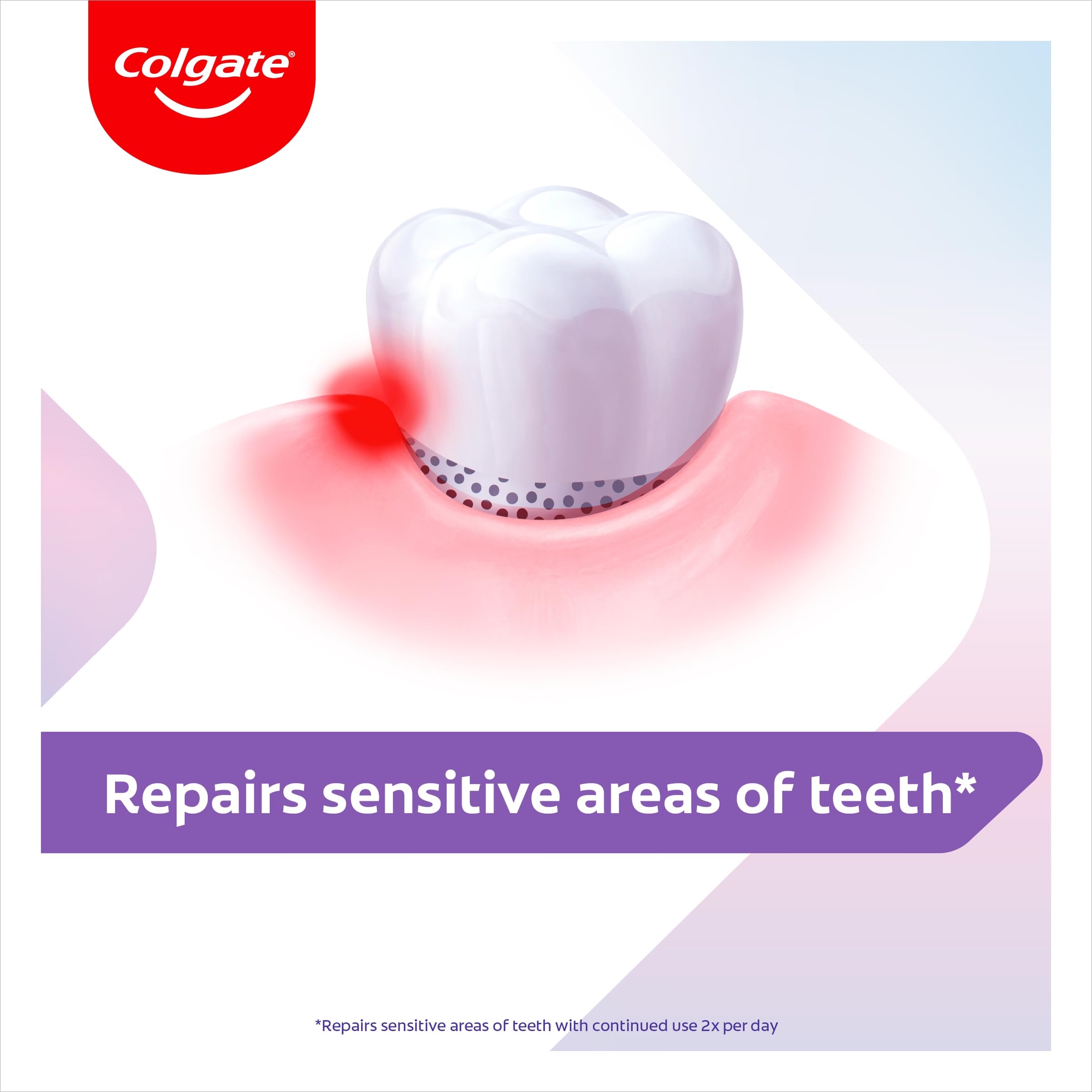 Colgate Sensitive Repair & Prevent + Gentle Whitening Toothpaste 75ml, Toothpaste for Sensitive Teeth, Acts in 1 Minute, Seals and Repairs Sensitive Areas of Teeth, Prevents Pain Coming Back