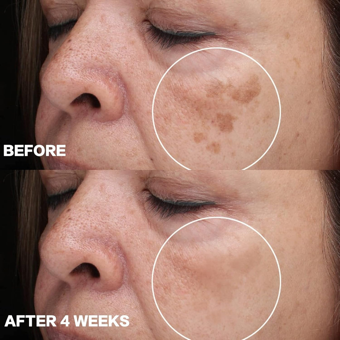 Dark Spot Remover for Face and Body: Dark Spot Corrector Cream - Enriching Skin Care for All Skin Tones - Ideal for Sun Spots, Melasma, Freckles, and Blemish Reduction 1 fl oz Halalzen