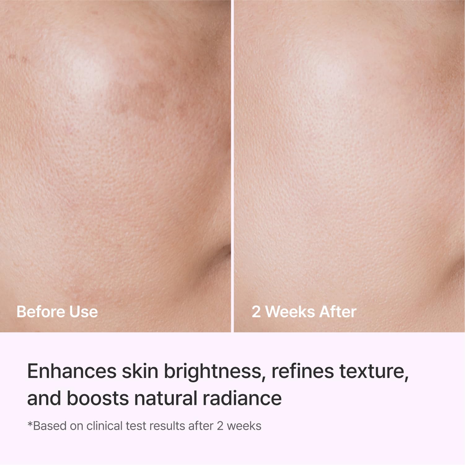 REJURAN® Dual Effect Ampoule, DOT DUAL c-PDRN® - Salmon DNA Face Serum for Deep Rejuvenation, Wrinkle Care, Firming, Skin Elasticity with Visible Anti-Aging Results. Korean Skincare (1.01 fl oz) Halalzen