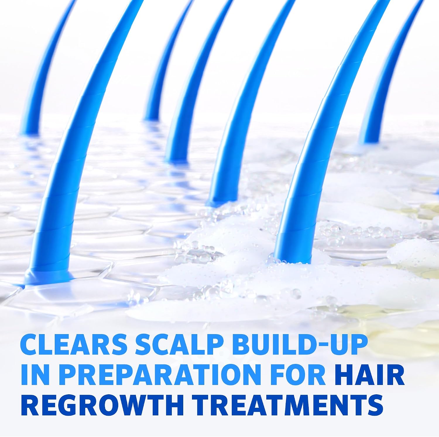 Regaine Pre-Growth 2in1 Shampoo and Conditioner 248 ml for Hair Care with Triple Acid Complex to Help Visibly Thicken and Prepare Scalp for Hair Regrowth Treatments