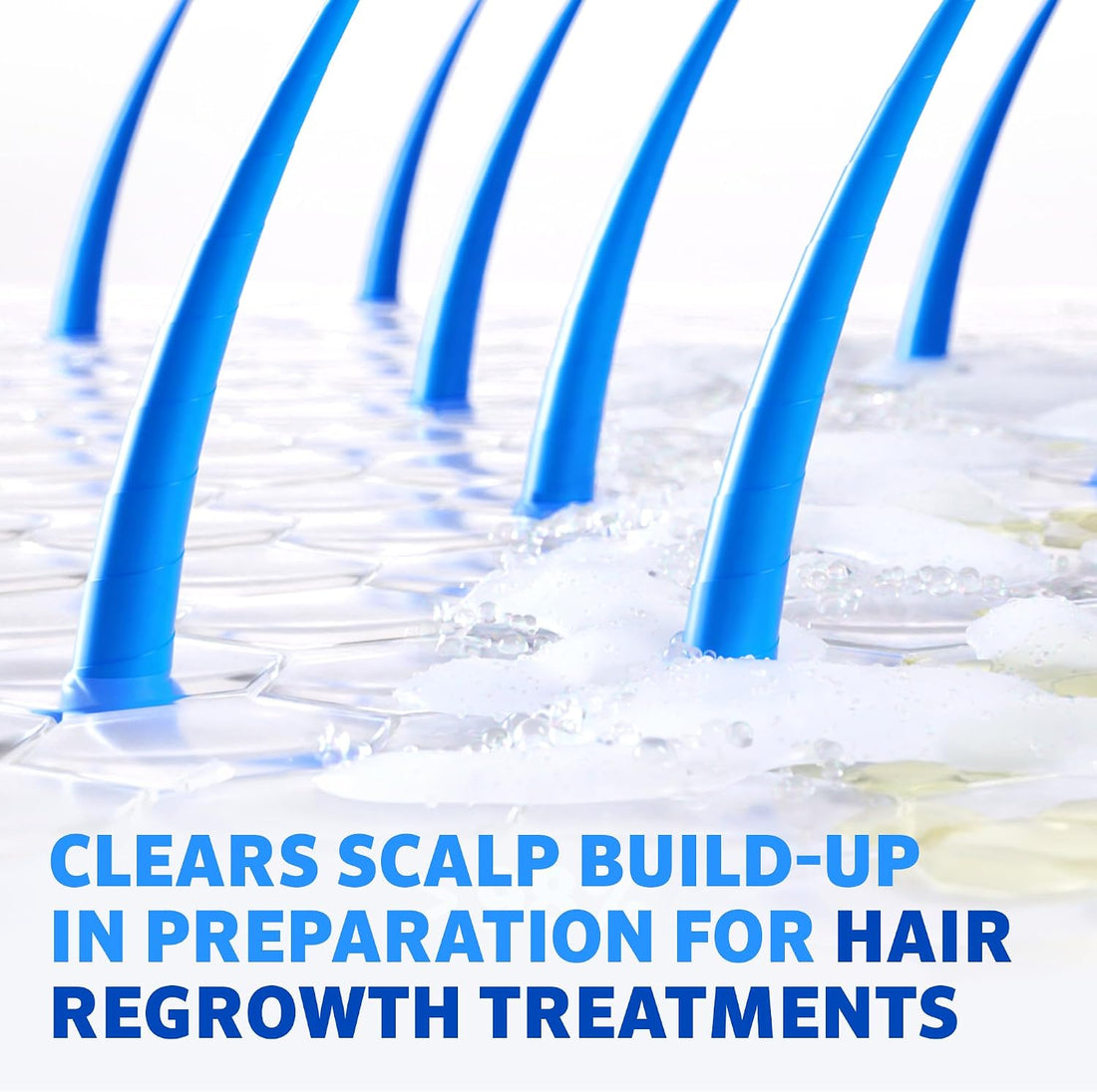 Regaine Pre-Growth 2in1 Shampoo and Conditioner 248 ml for Hair Care with Triple Acid Complex to Help Visibly Thicken and Prepare Scalp for Hair Regrowth Treatments