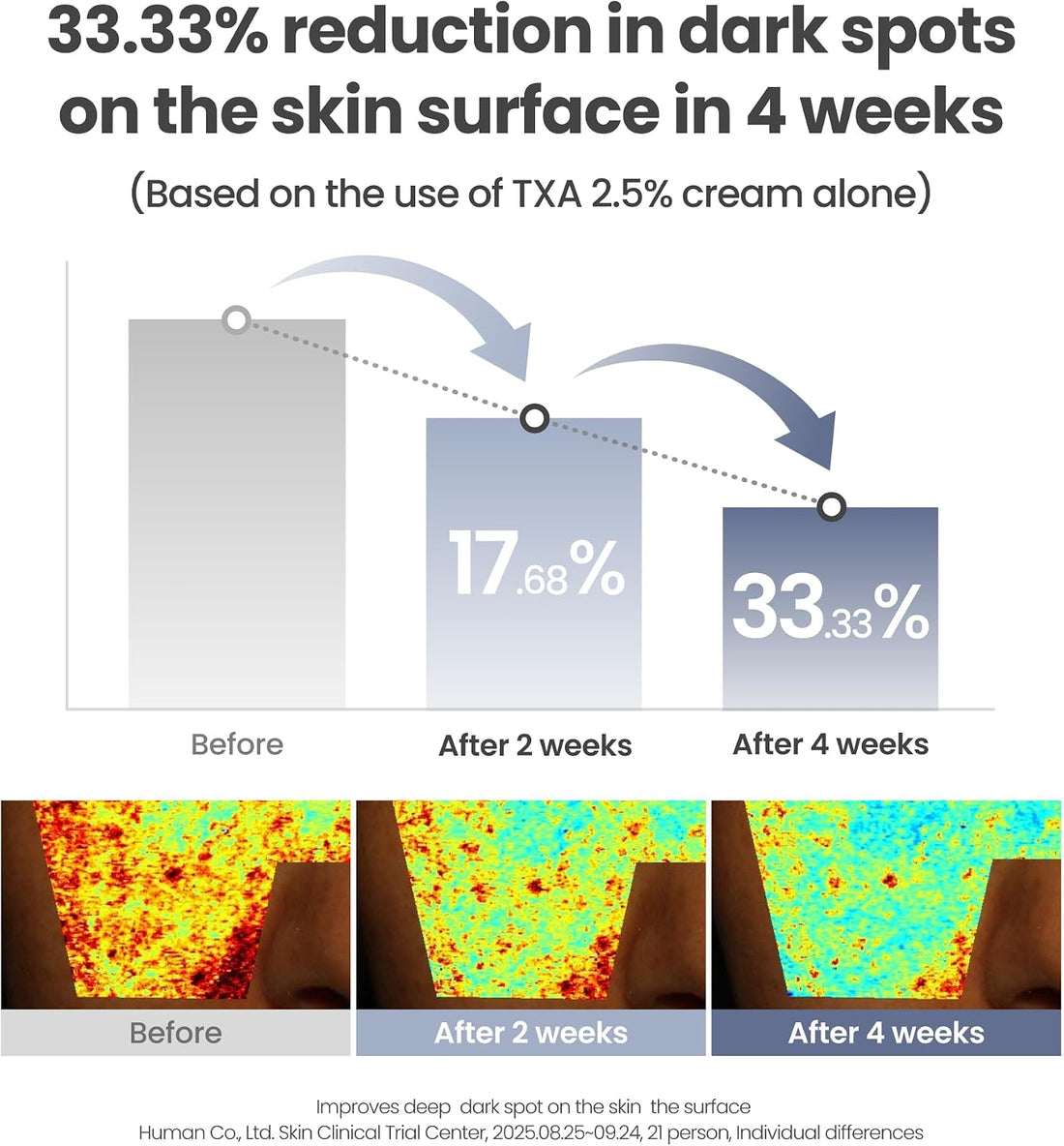 AXIS-Y TXA 2.5% Intensive Brightening Cream - Tranexamic Acid, Niacinamide & Glutathione for Hyperpigmentation & Dark Spot Corrector - Vegan Korean Skin Care Moisturizer Face Cream - 50ml/1.69 fl. oz.