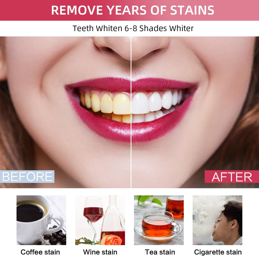 Teeth Whitening Kit with LED Light + 5 Teeth Whitening Gel - Gentle Whitening on Sensitive Teeth - Fast Removes Stubborn Stains - Professional Teeth Whitening for Home - Wireless & Water-Resistant