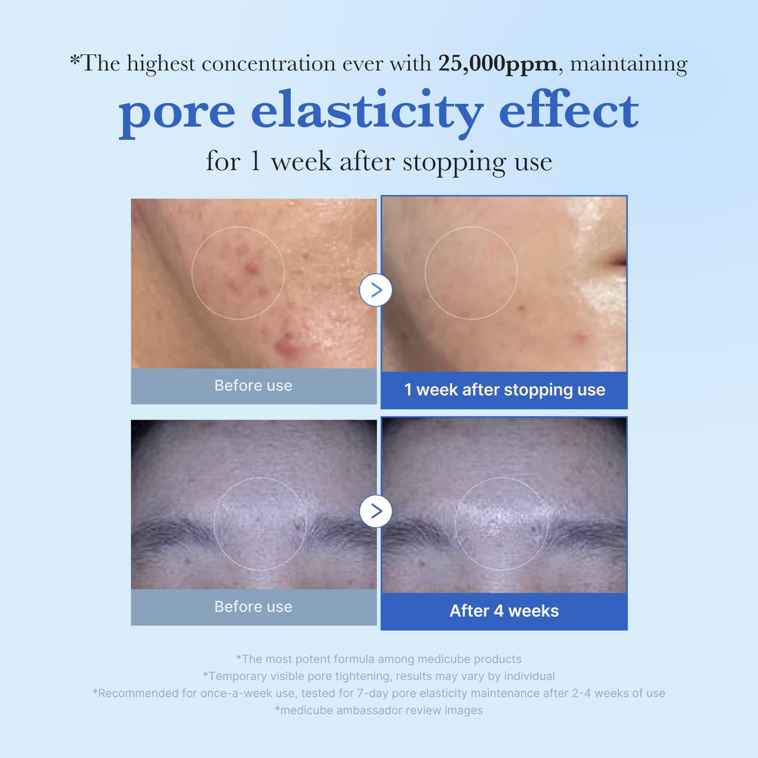 medicube Exosome Shot Zero 2,000 PPM Spicule Facial Serum | Liquid Skin Booster Serum | Exosome, AHA+BHA+PHA | Pore Care, Dead Skin Cells, Skin Texture | Korean Skincare, 1.01 fl.oz Halalzen