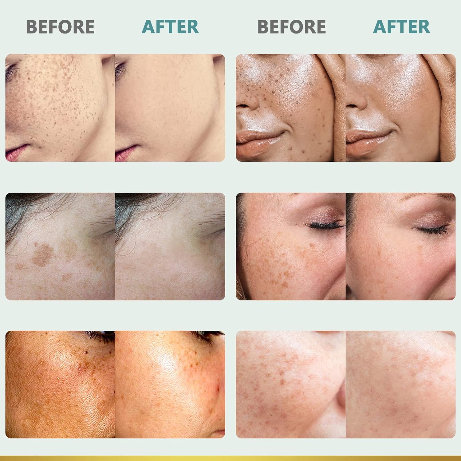 Dark Spot Remover for Face and Body: Dark Spot Corrector Cream - Enriching Skin Care for All Skin Tones - Ideal for Sun Spots, Melasma, Freckles, and Blemish Reduction 1 fl oz Halalzen