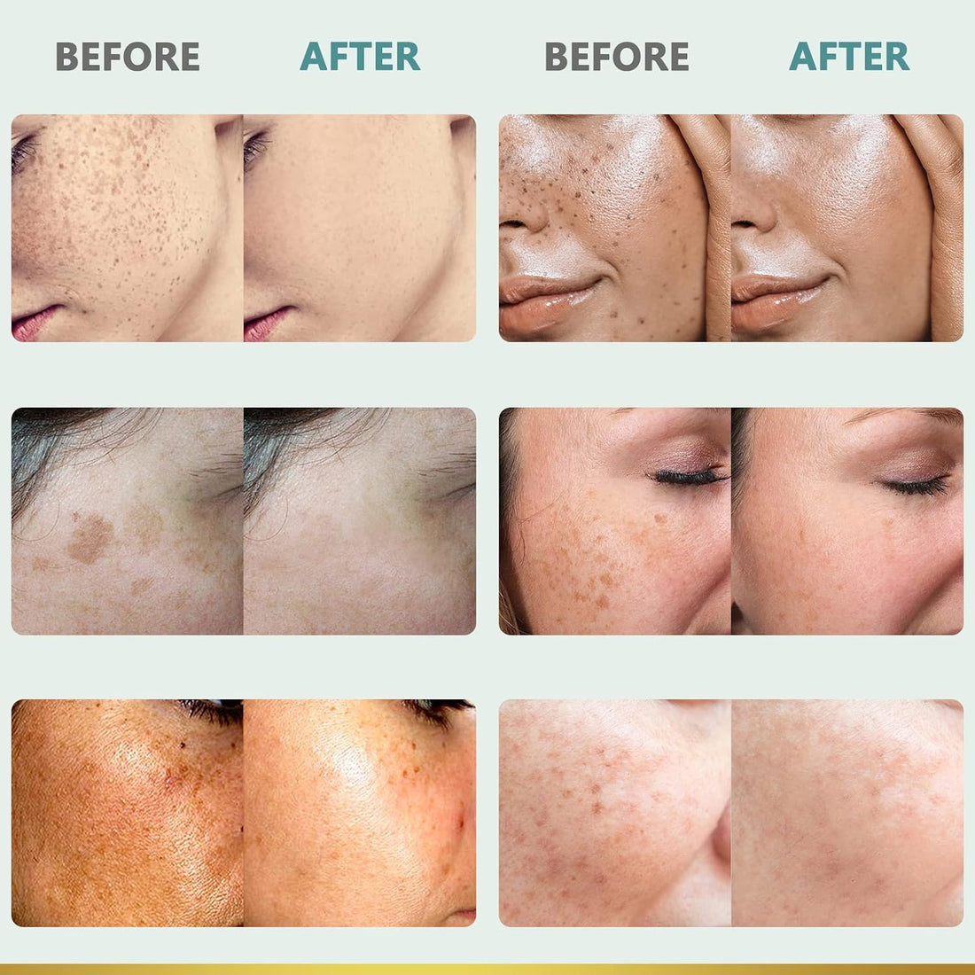 Dark Spot Remover for Face and Body: Dark Spot Corrector Cream - Enriching Skin Care for All Skin Tones - Ideal for Sun Spots, Melasma, Freckles, and Blemish Reduction 1 fl oz Halalzen