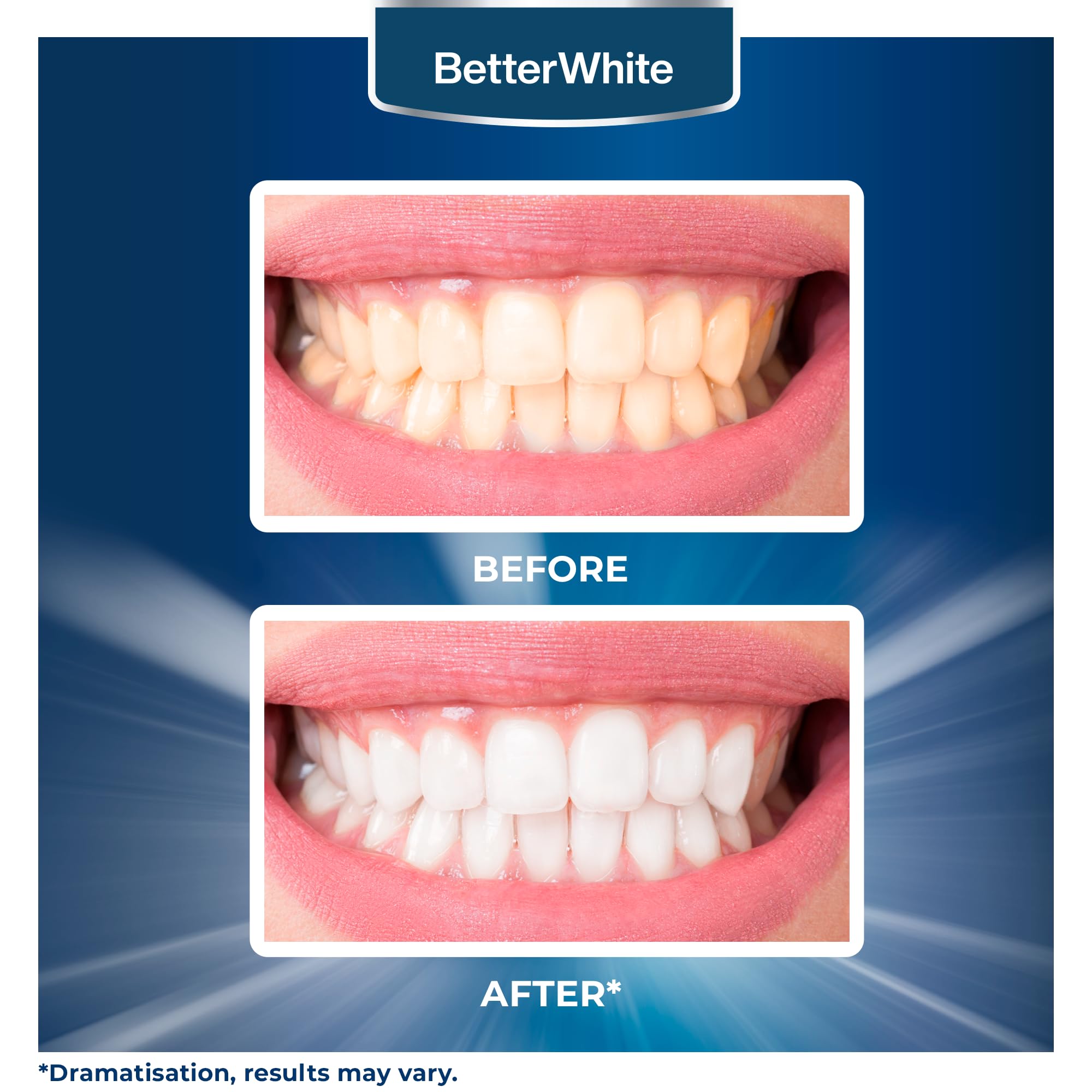 BetterWhite Teeth Whitening Powder - Dentist-Approved & Enamel-Safe | 6 Month Supply | Tea, Coffee, Wine & Smoking Stain Remover | Non-Sensitive Formula | Peroxide-Free | HAP, Baking Soda & Xylitol